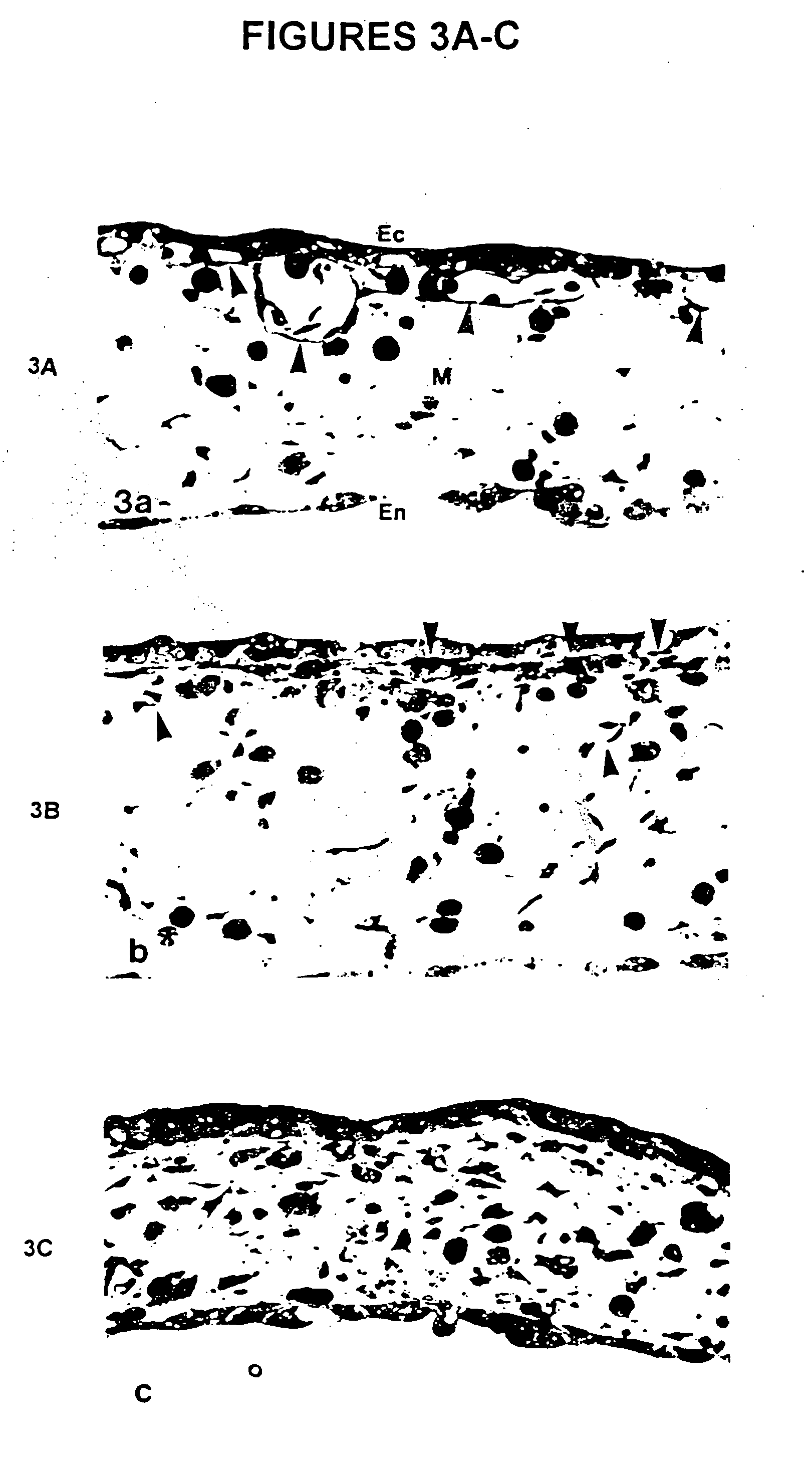 Anti-angiogenic compositions and methods of use