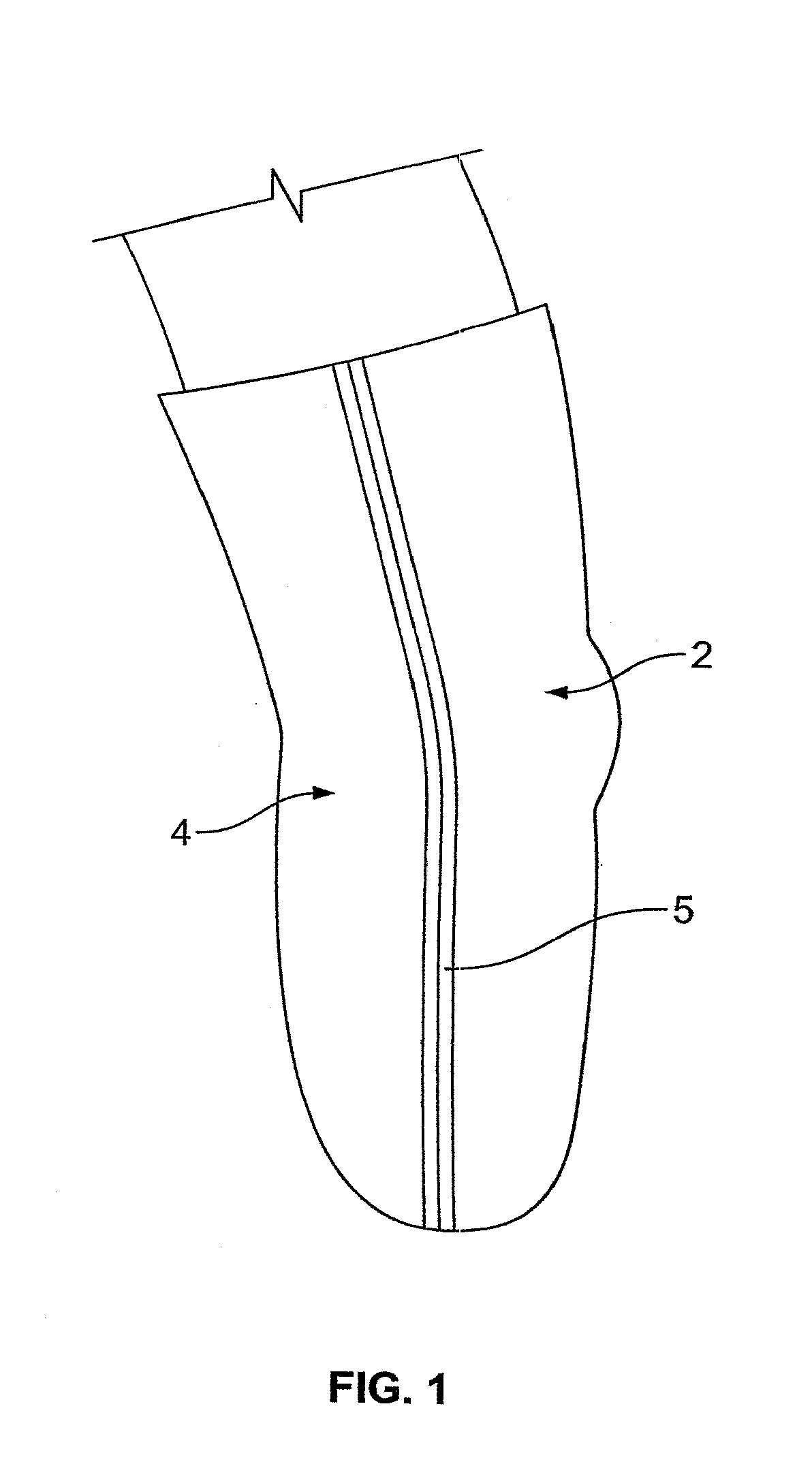 Prosthetic Locking Liner With Improved Knee Flexion