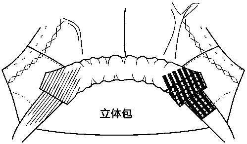 Fine sewing method of high-grade manually customized upper garment