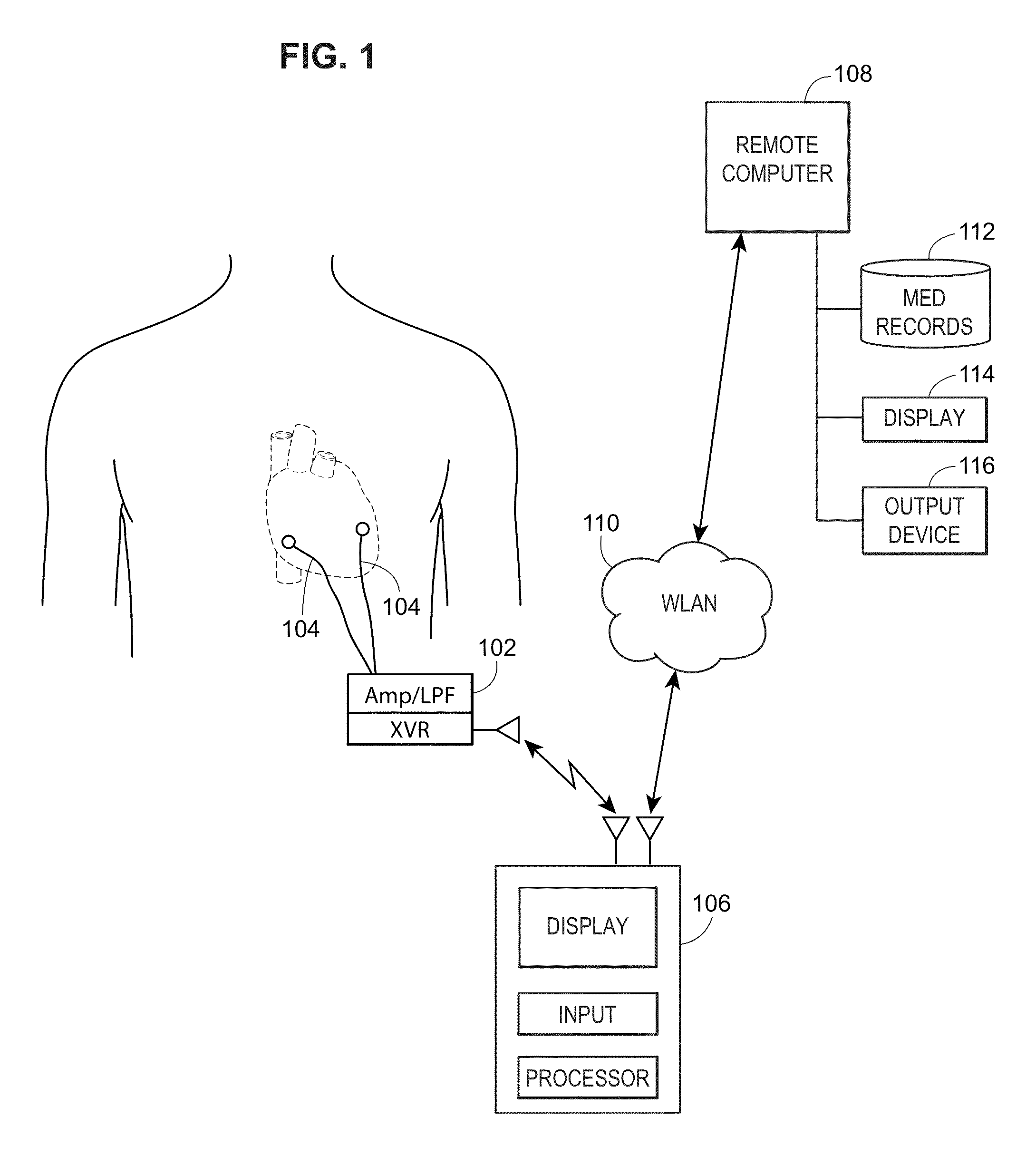 Atrial fibrillation classification using power measurement