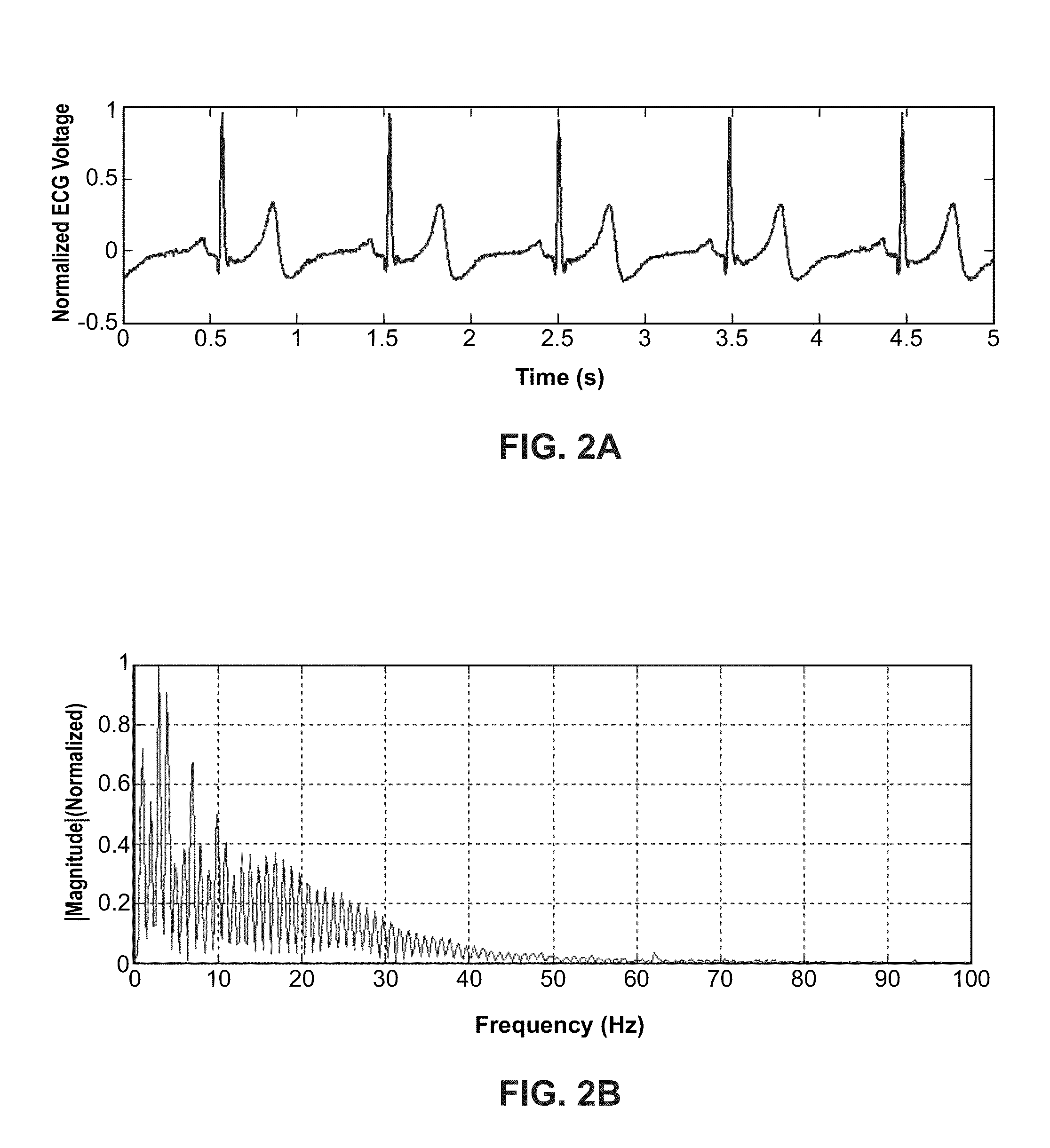 Atrial fibrillation classification using power measurement