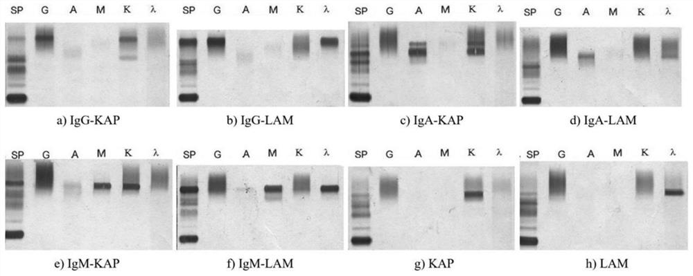 A key region identification method for immunofixation electrophoresis