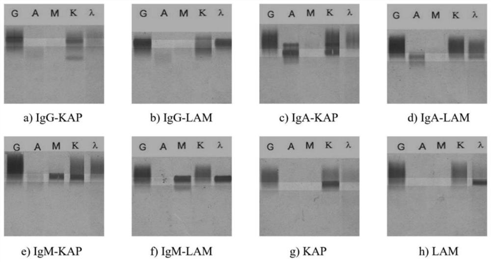 A key region identification method for immunofixation electrophoresis