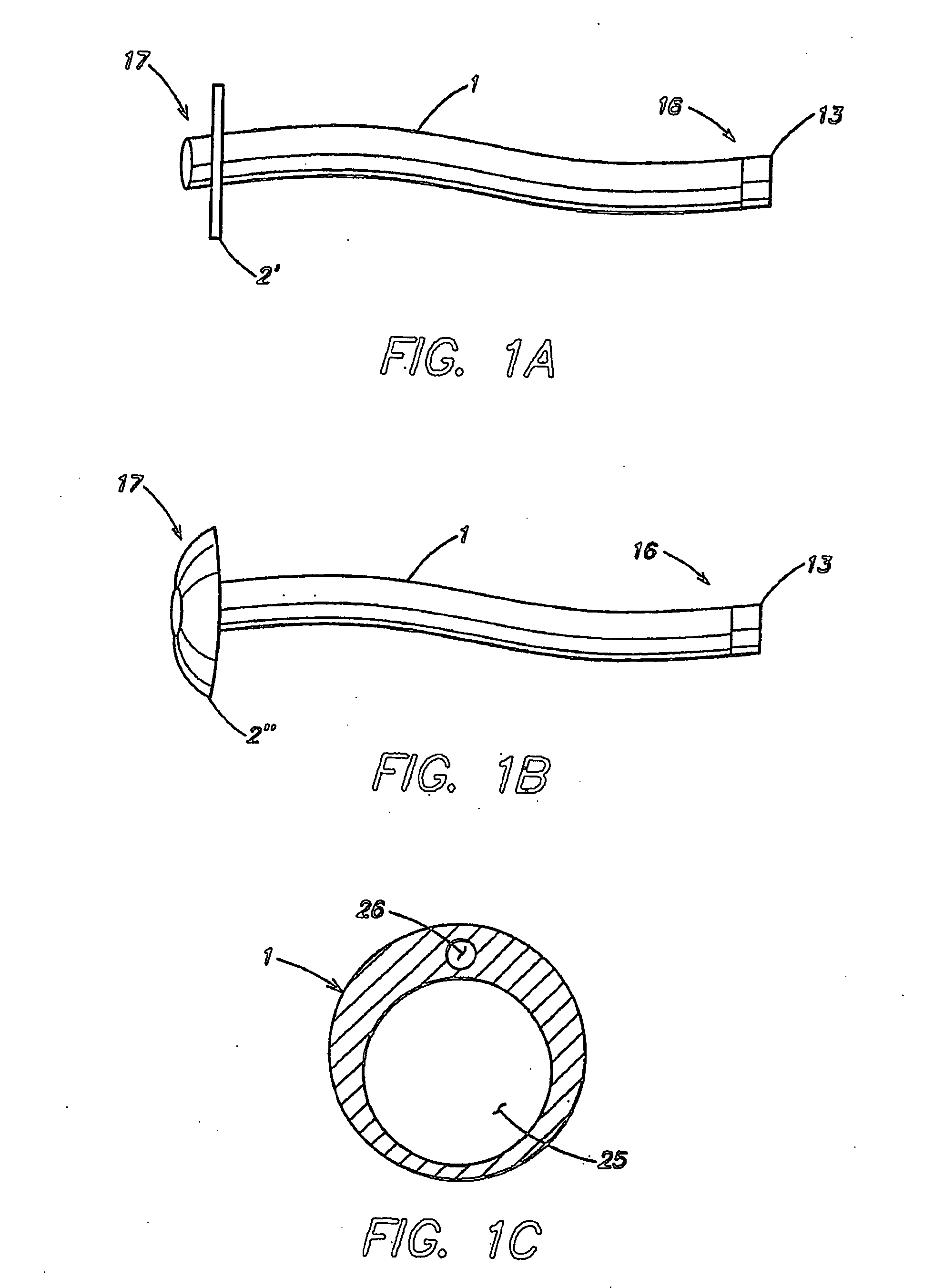 Apparatus for treating obesity by extracting food