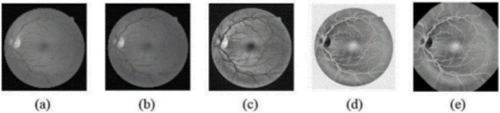 Non-fluorescent eye fundus image based automatic segmentation method for retinal blood vessels