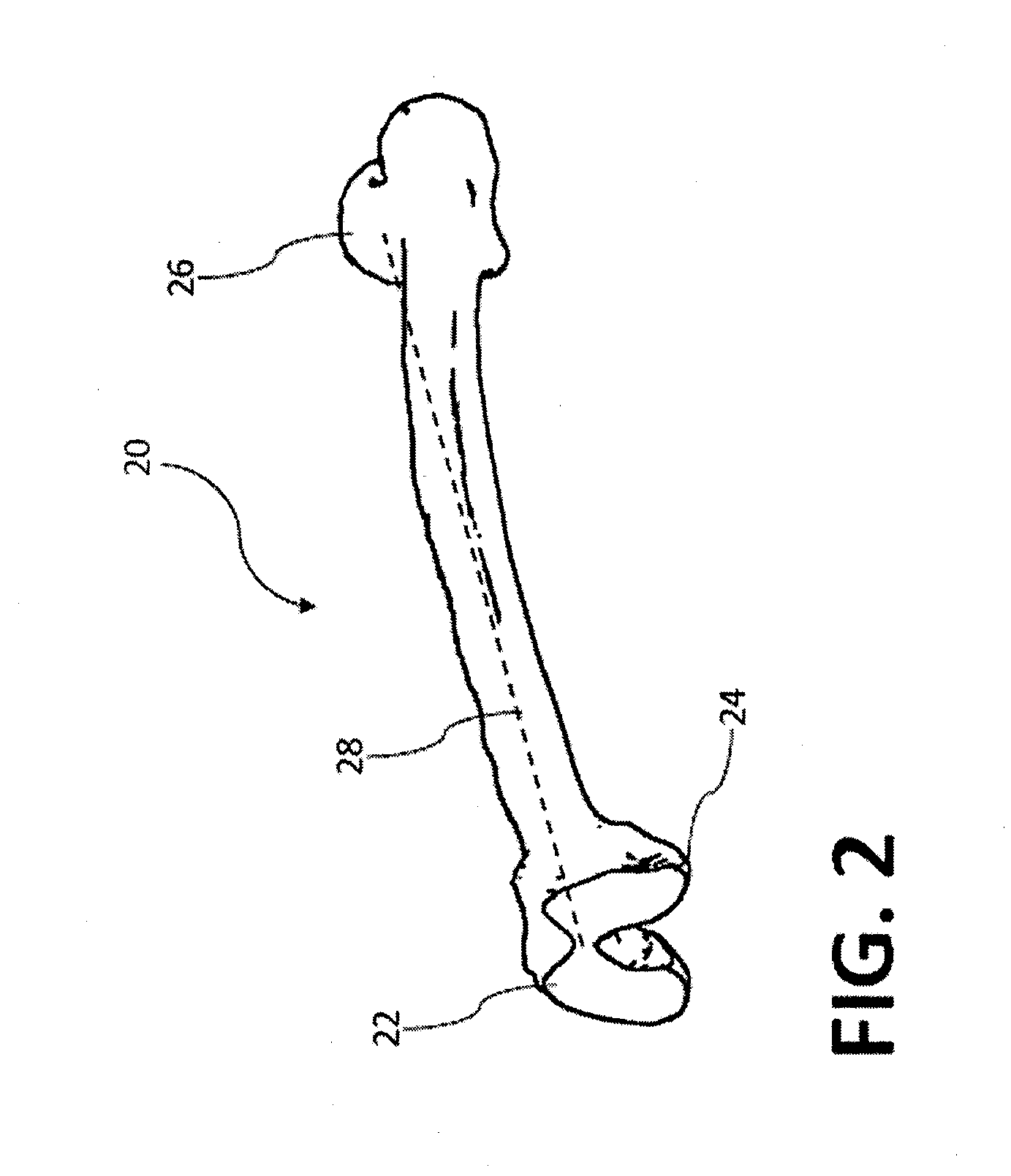 Devices and methods for knee arthroplasty