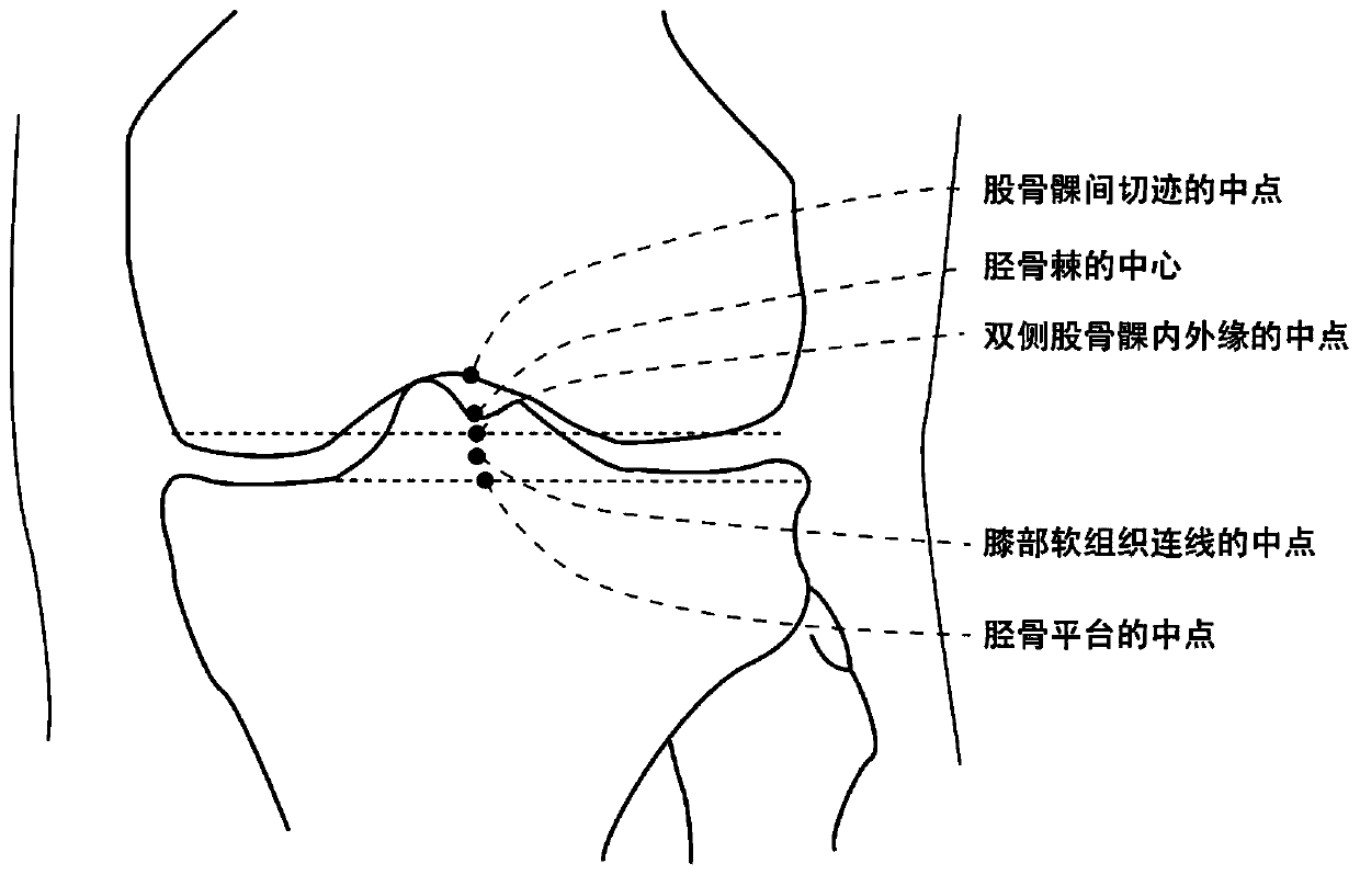 Leg-bone lower limb force line automatic detection method and device