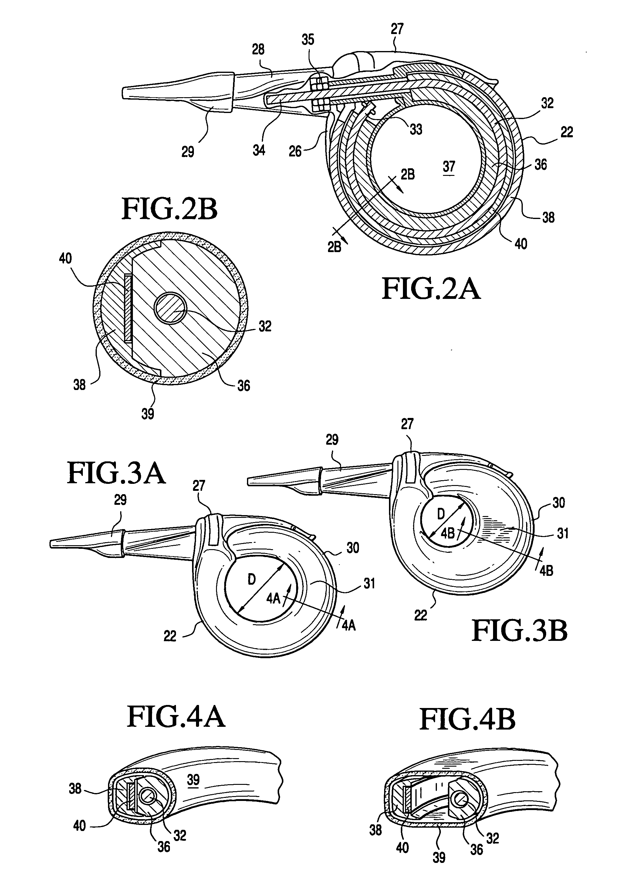 Telemetrically controlled band for regulating functioning of a body organ or duct, and methods of making, implantation and use