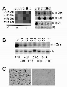 Application of miRNA-29a compound as brain glioma marker