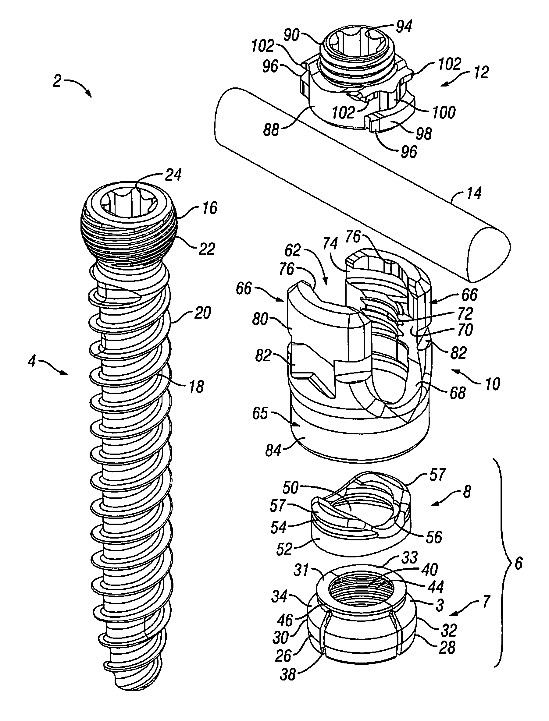 Orthopedic fixation devices and methods of installation thereof