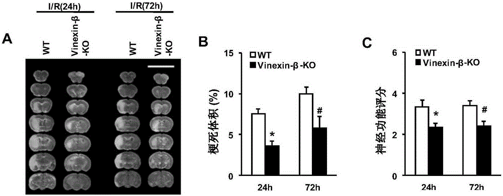 Application of vinexin-β in the treatment of stroke