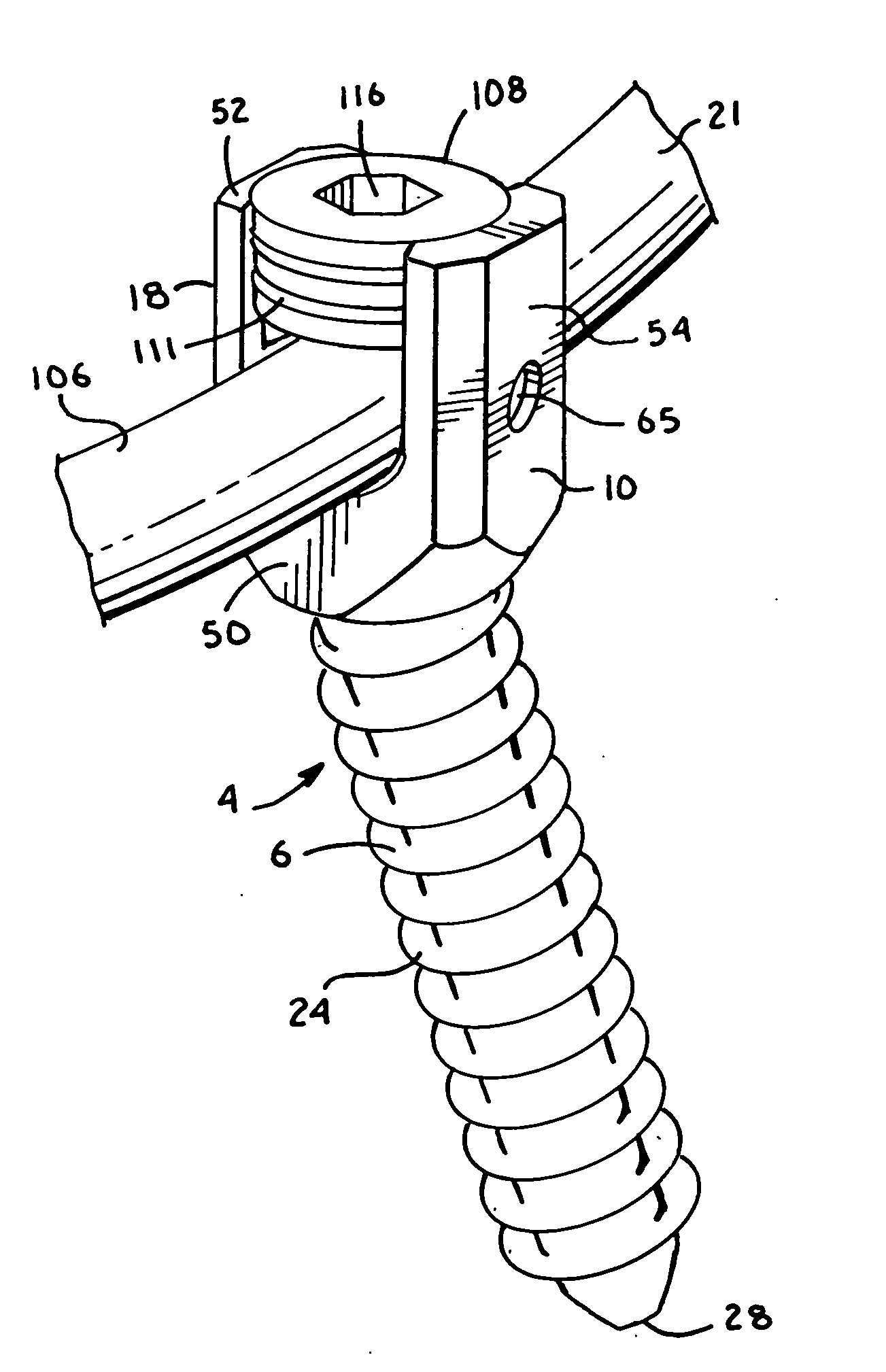 Polyaxial bone screw with helically wound capture connection