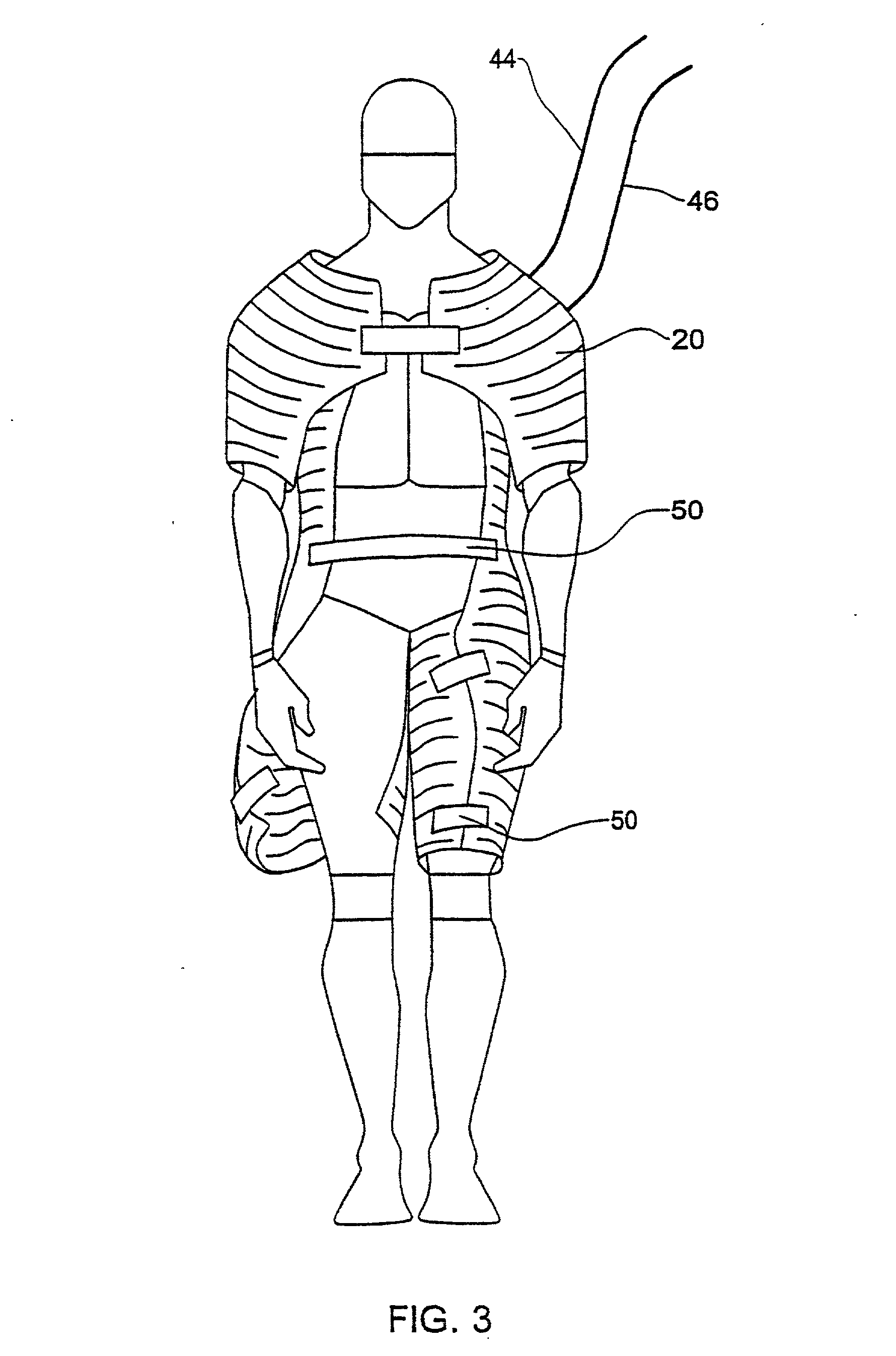 Method and system for improving cardiovascular parameters of a patient