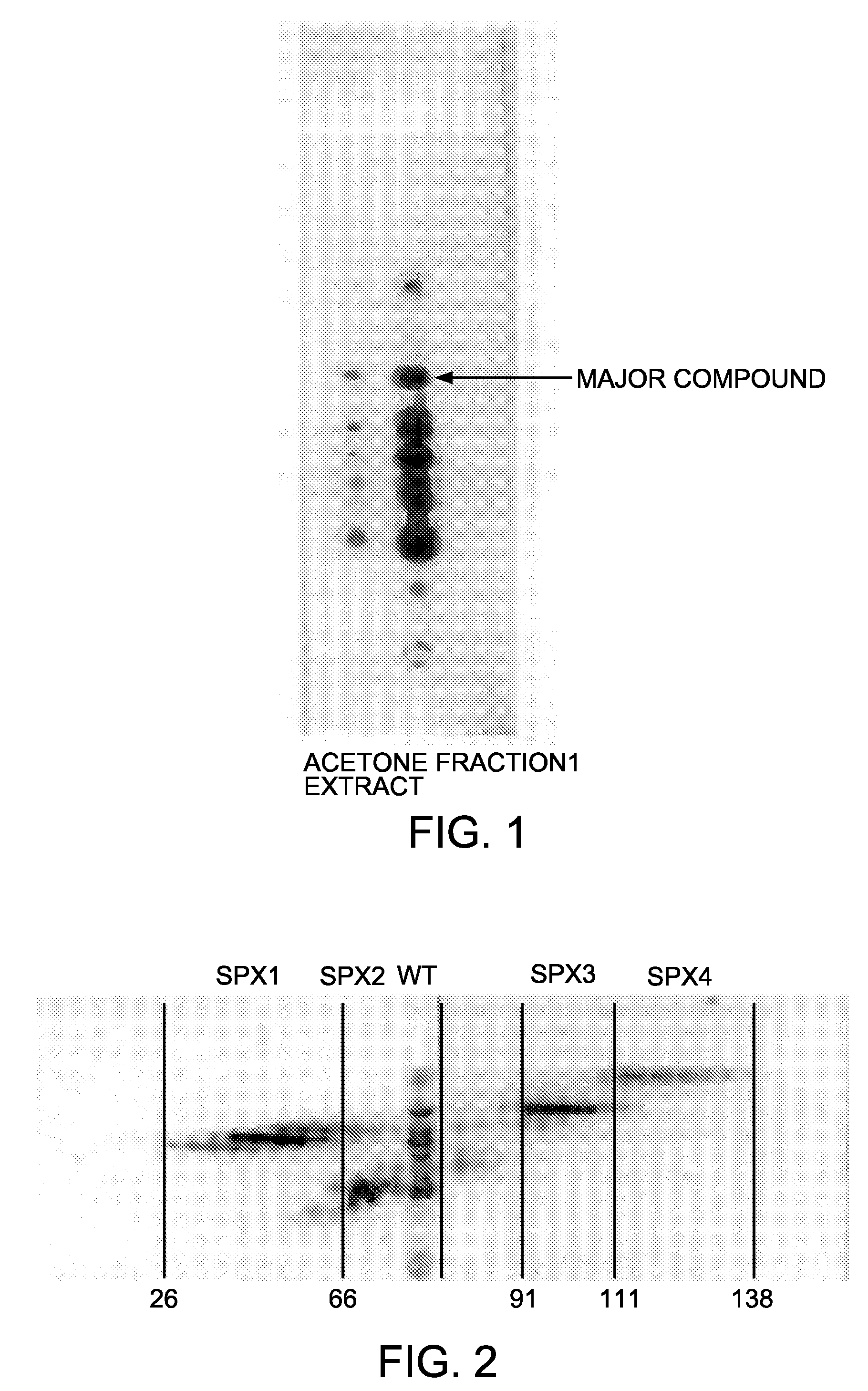 Use of hederagenin 3-0 alpha-l-rhamnopyranosyl(1-2)-(beta-d-glucopyranosyl(1-4)-alpha-l-arabinopyranoside or an extract from pulsatillae radix containing the same as a therapeutic agent for solid tumors