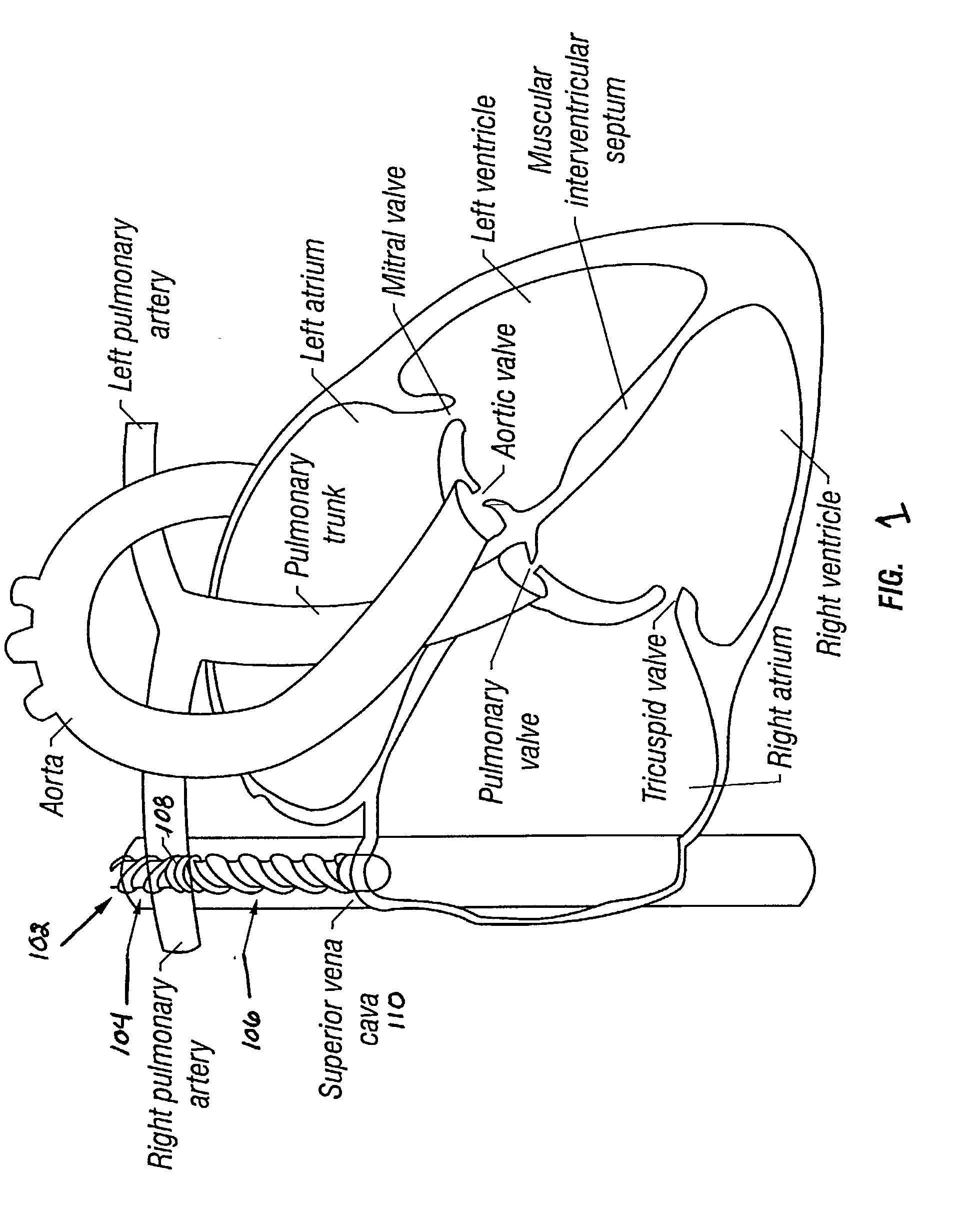 Method and apparatus for patient temperature control employing administration of anti-shivering agents