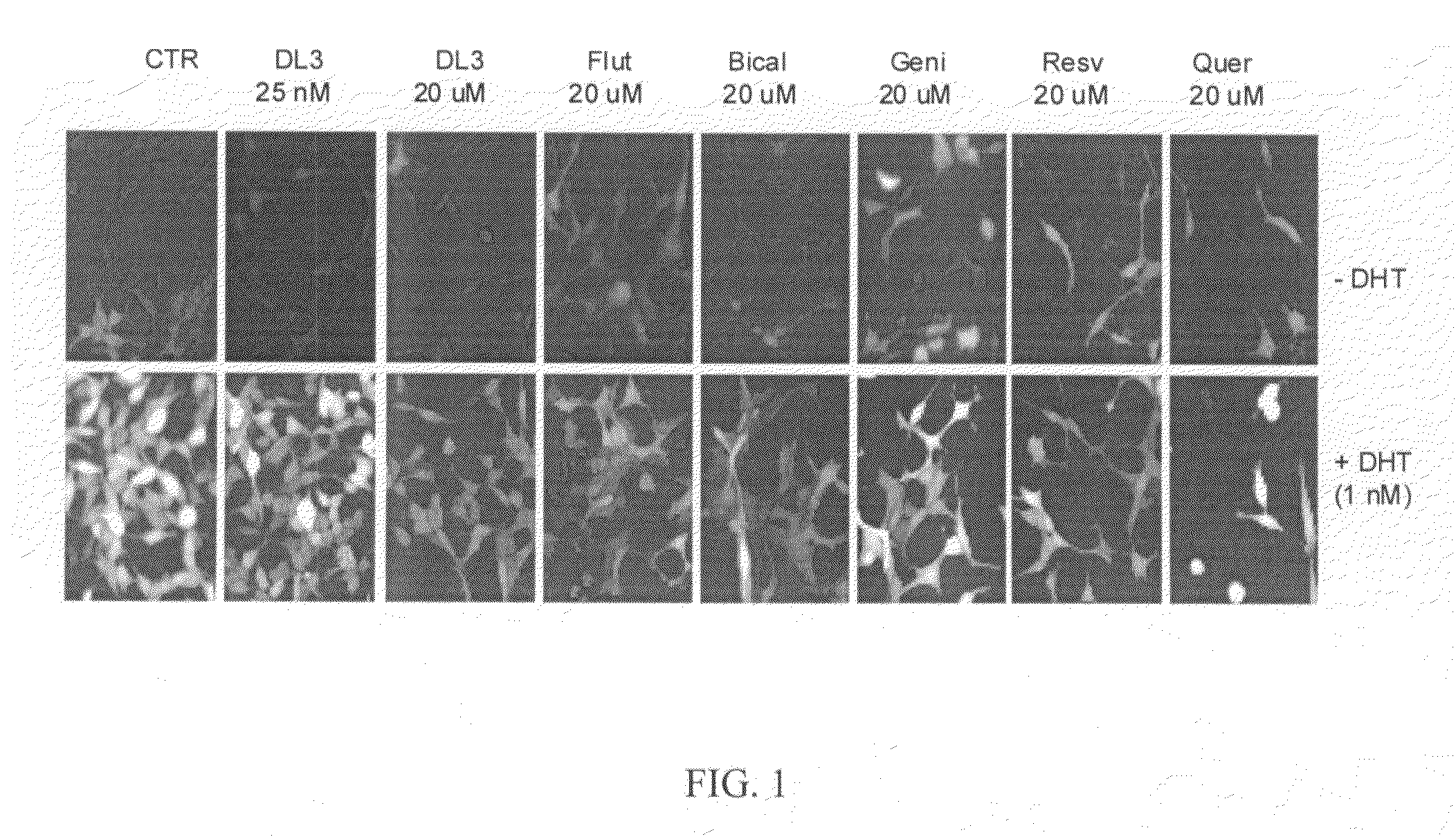 Methods for treating androgen receptor related disorders