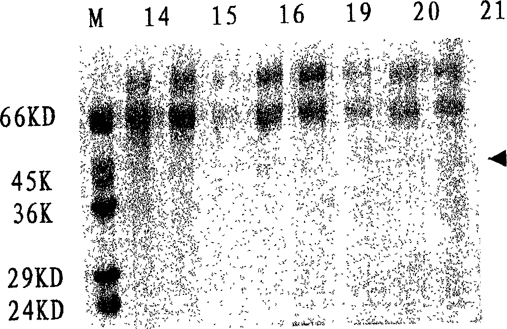 Mumps virus ingredient vaccine for human, and its preparation method and uses