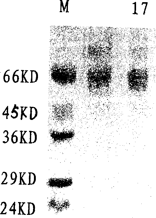 Mumps virus ingredient vaccine for human, and its preparation method and uses