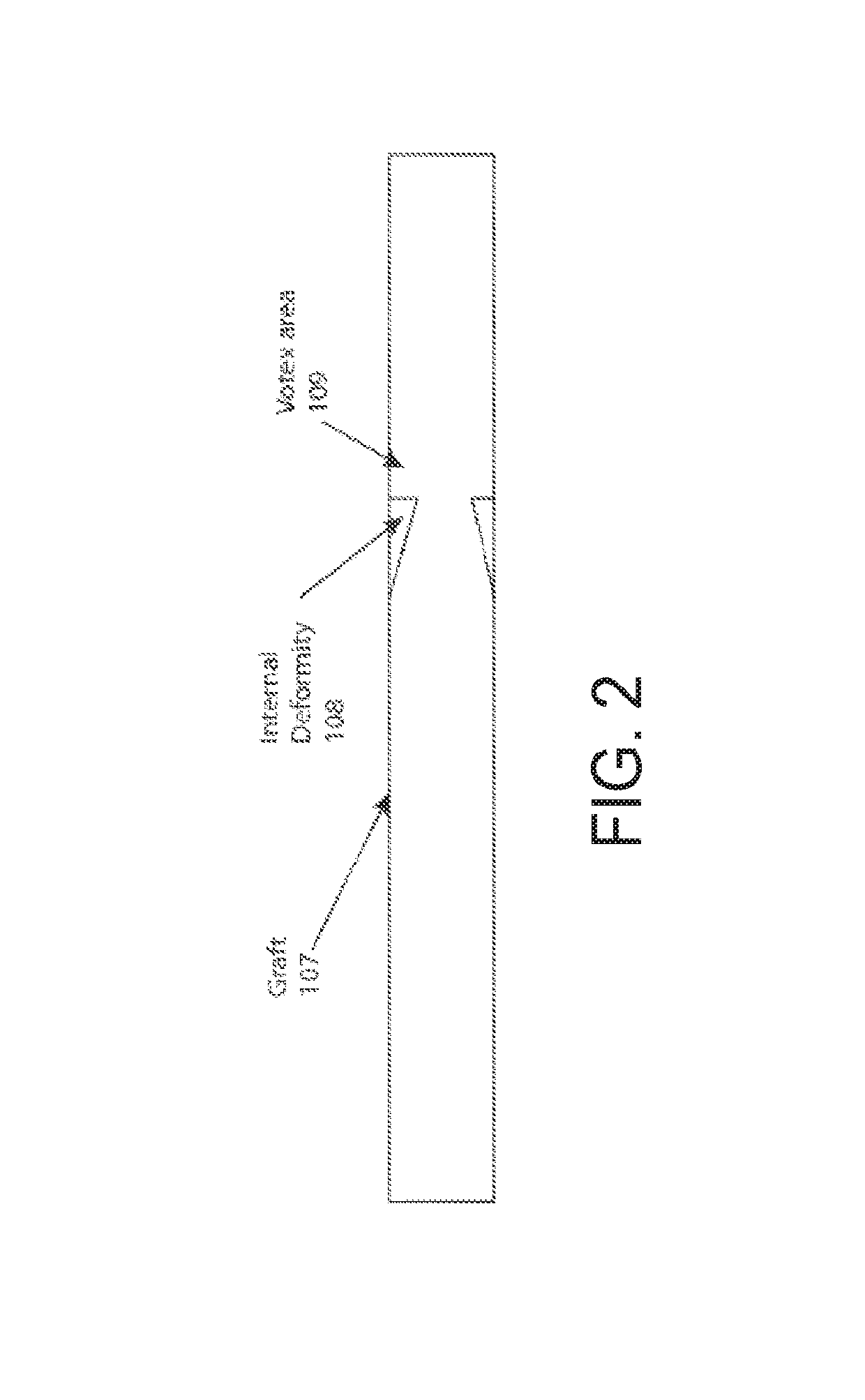 Graft anchor devices, systems and methods