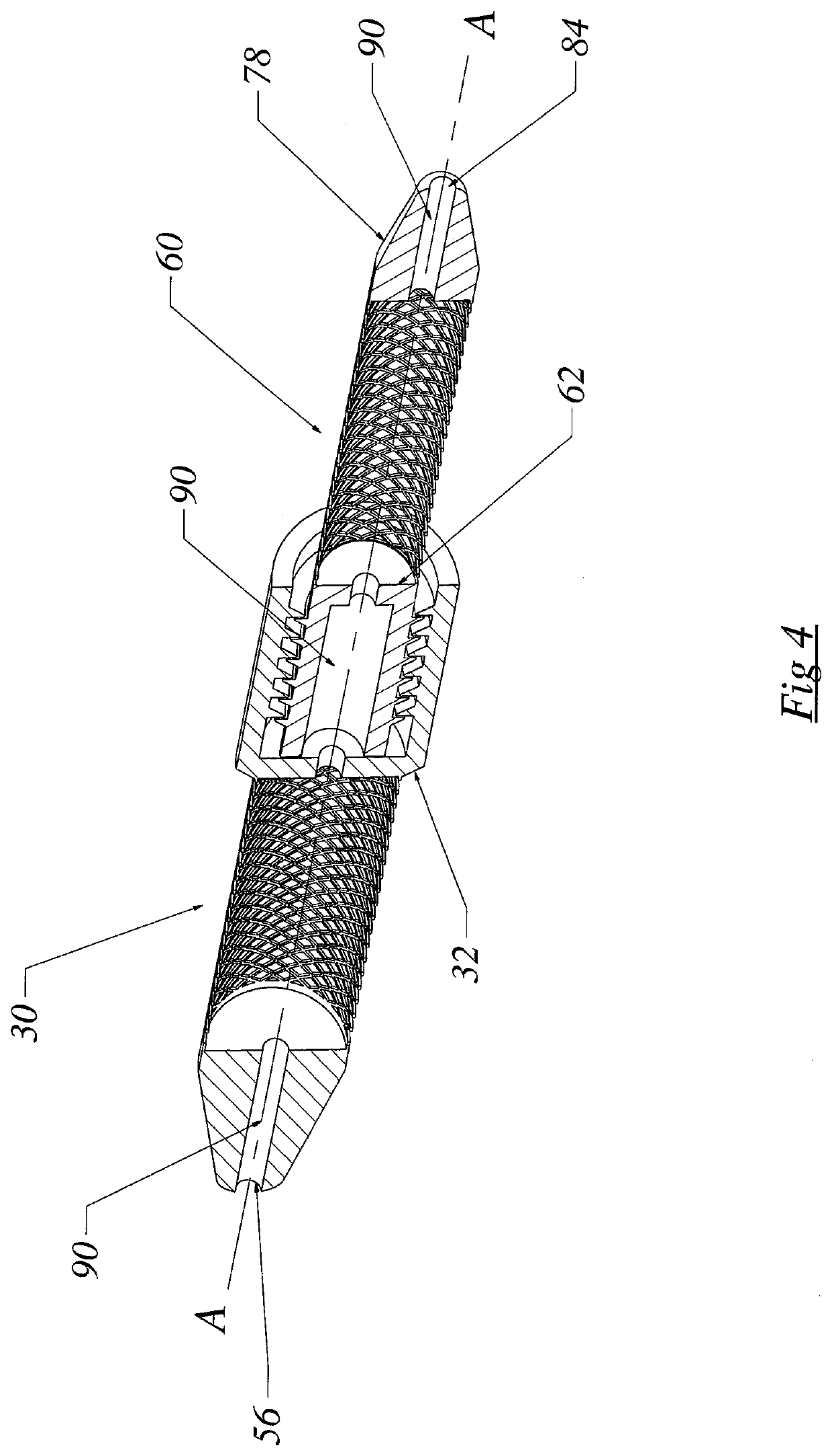 Long Bone Fracture Reduction System