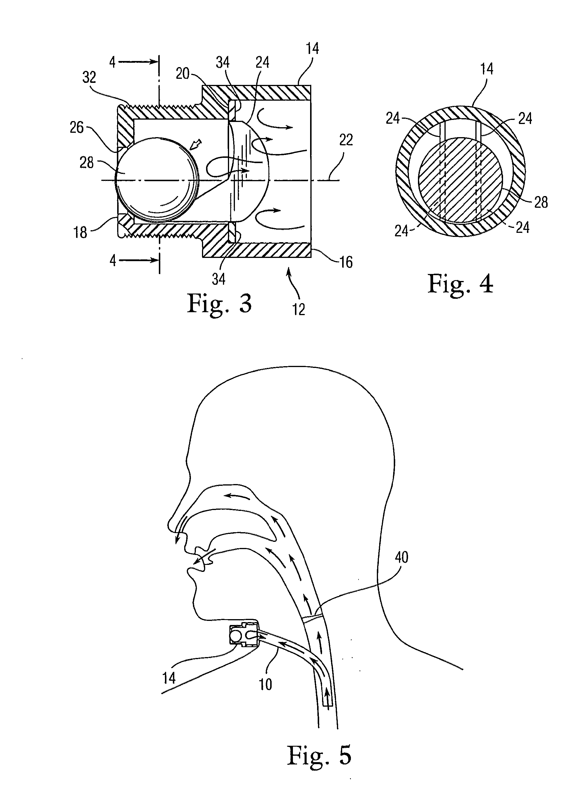 Low profile heat and moisture exchanger device for tracheotomy and speaking valve
