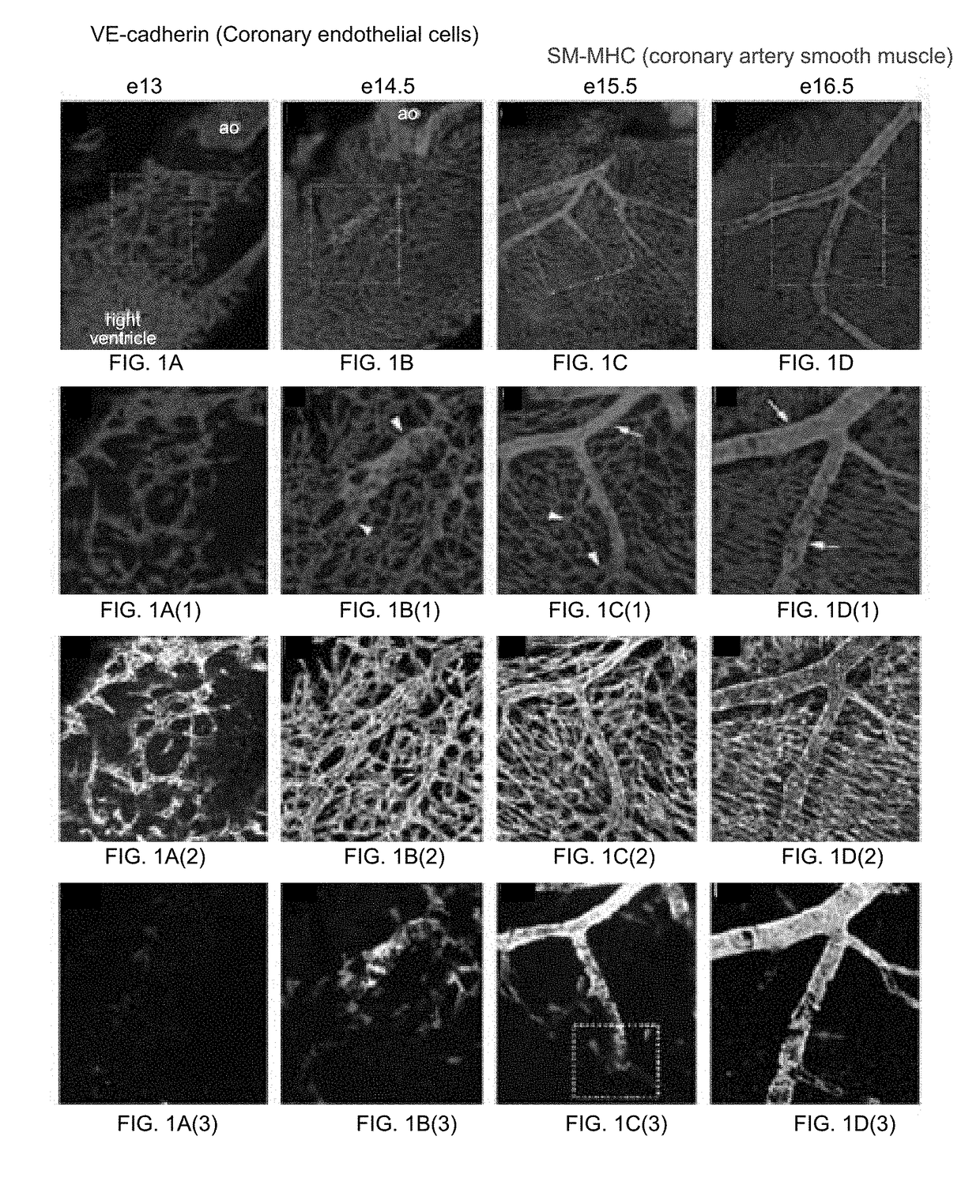 Pericytes are intermediate progenitors for epicardial derived coronary artery smooth muscle