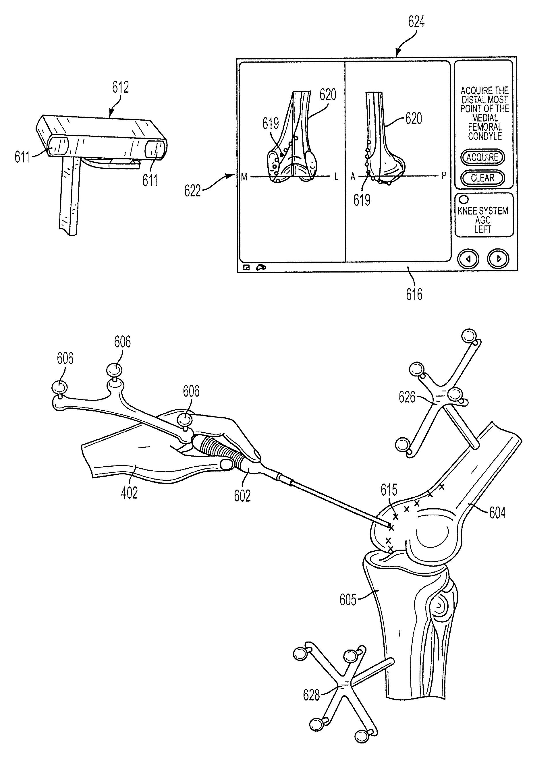 Modeling method and apparatus for use in surgical navigation