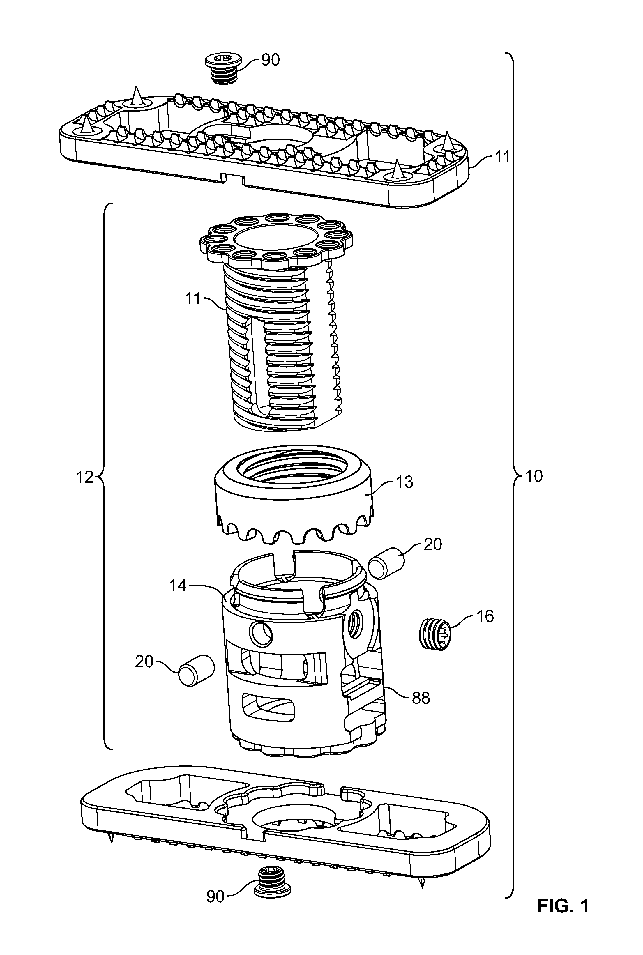 Vertebral Body Replacement