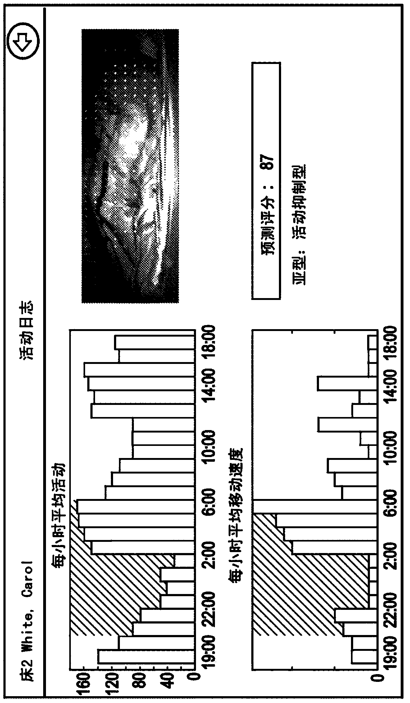 Monitoring system for monitoring a patient and detecting delirium of the patient