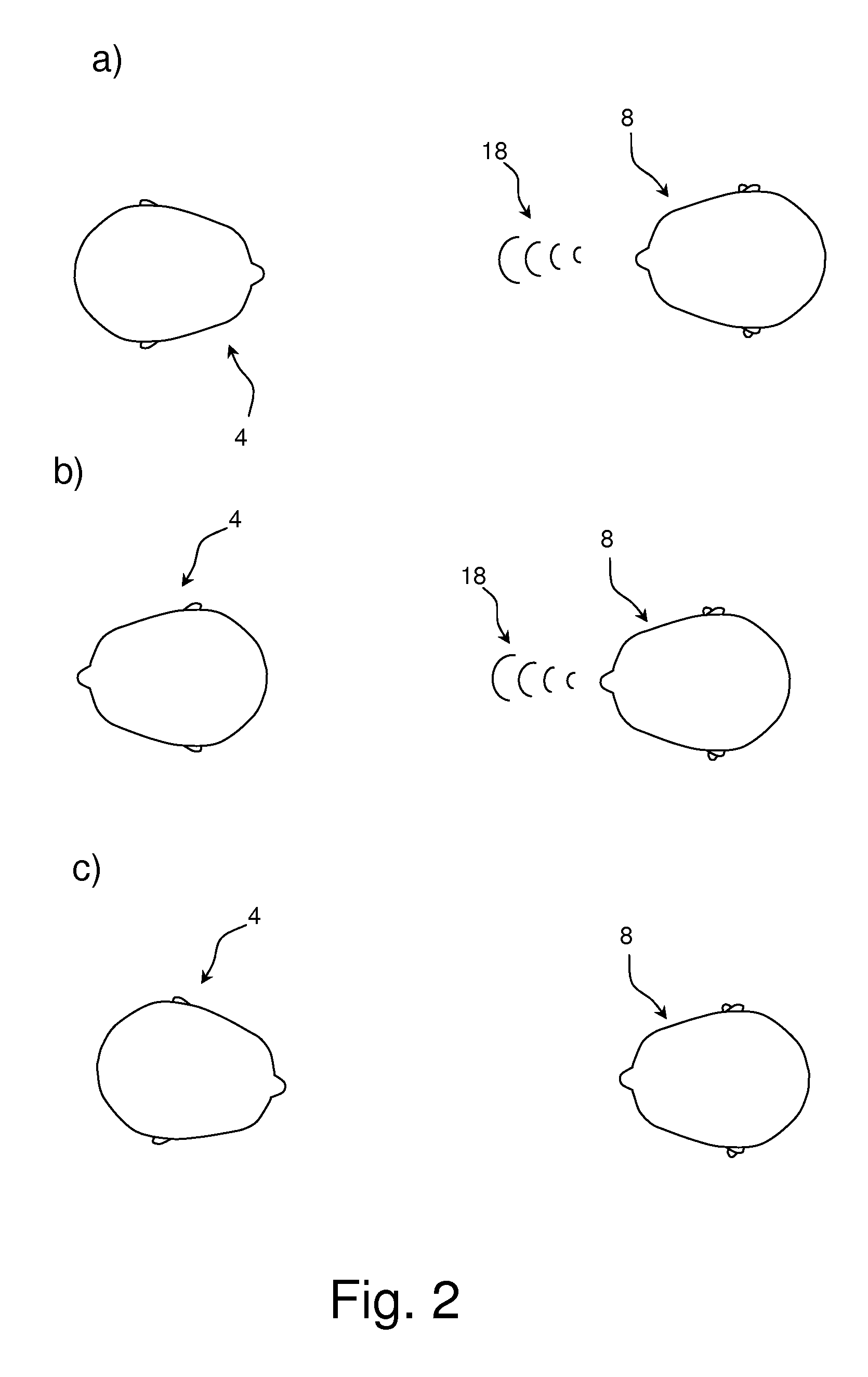 Hearing aid specialized as a supplement to lip reading