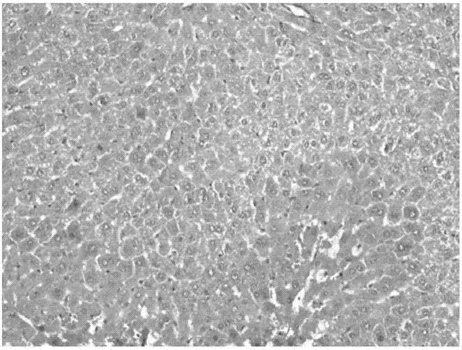 Application of nutmeg lignan to preparation of liver protection drugs