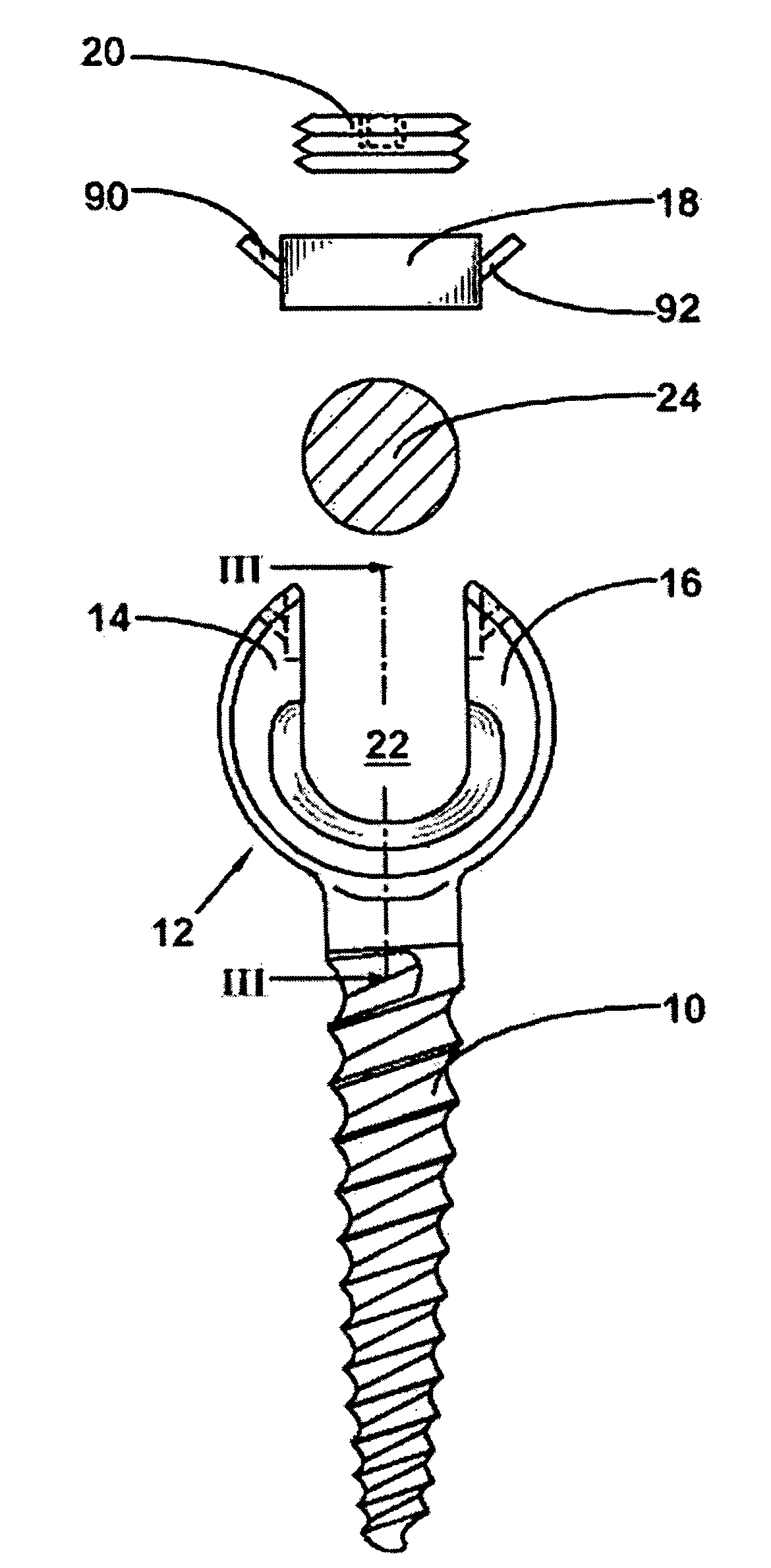 Anchoring element for securing a rod on a vertebra
