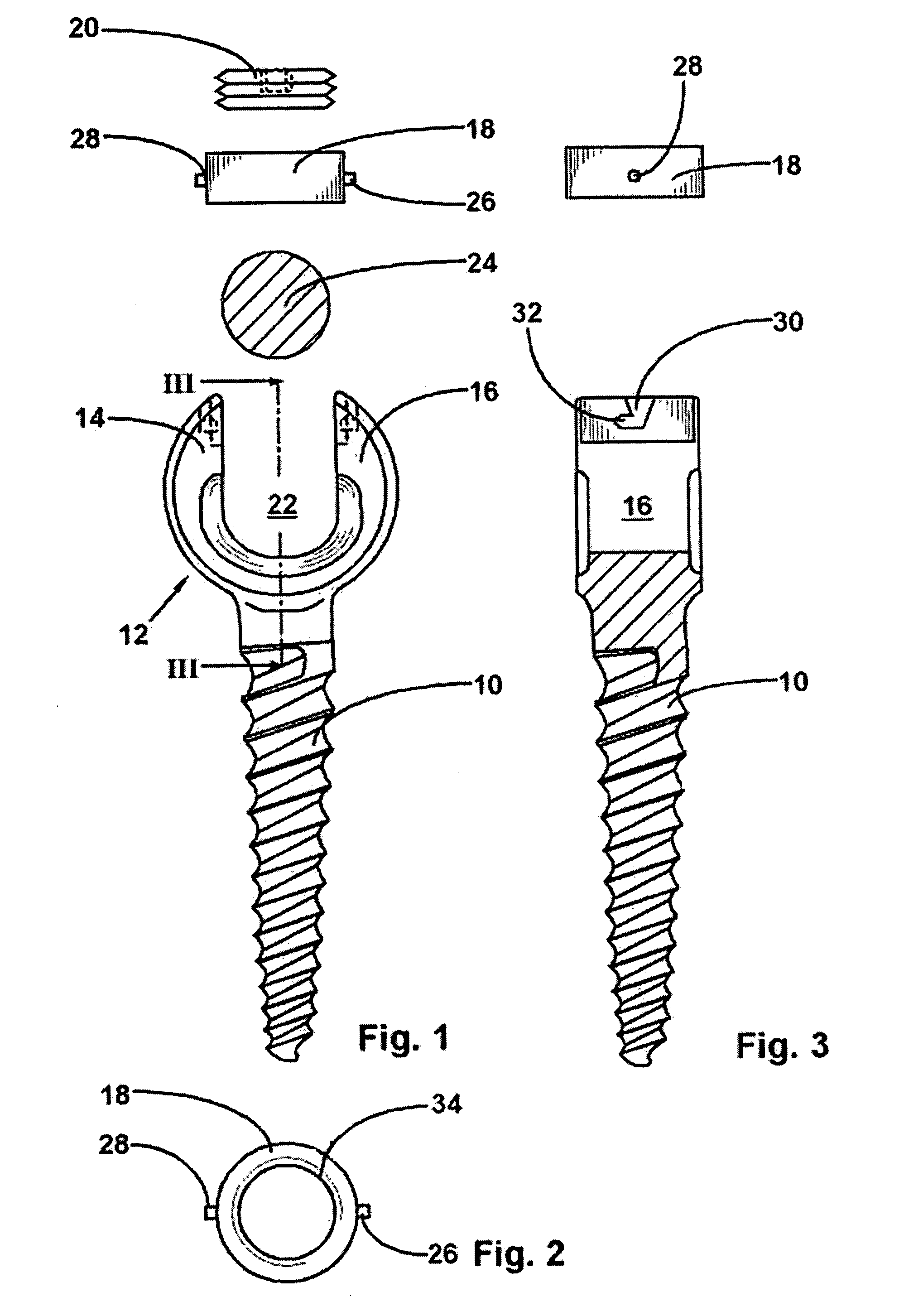Anchoring element for securing a rod on a vertebra