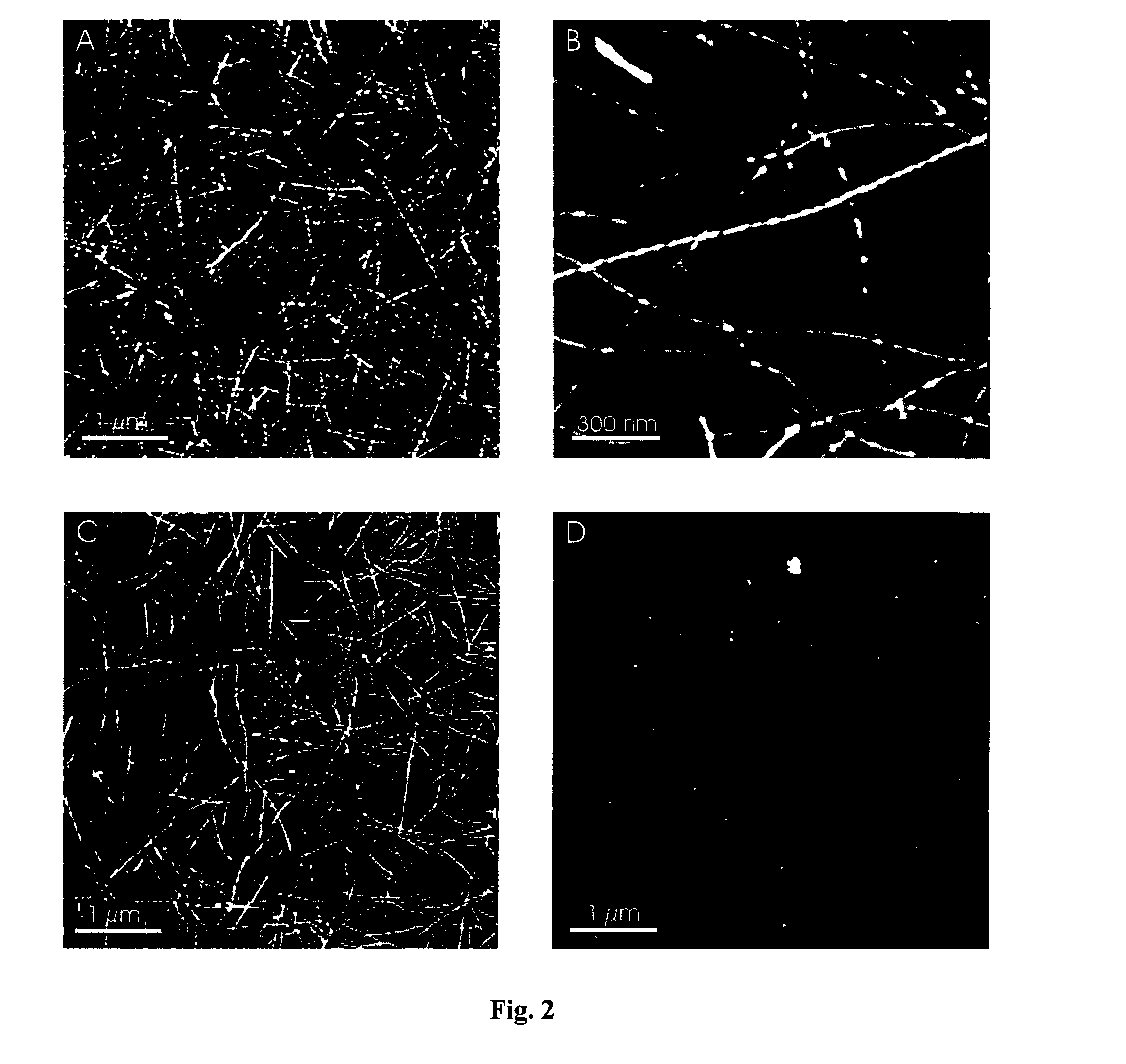 Compositions and methods for removal or destruction of amyloid fibril or amyloid adhesin comprising aggregates