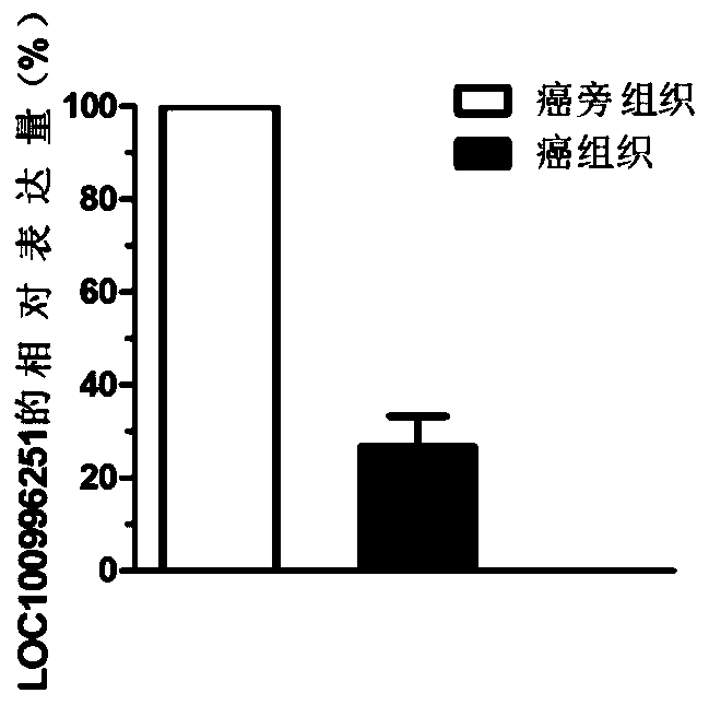 A biomarker related to the occurrence and development of breast cancer and its application