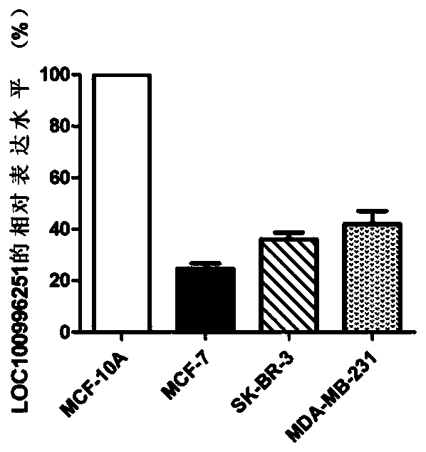 A biomarker related to the occurrence and development of breast cancer and its application