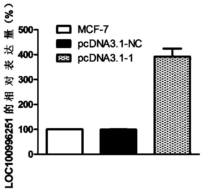 A biomarker related to the occurrence and development of breast cancer and its application