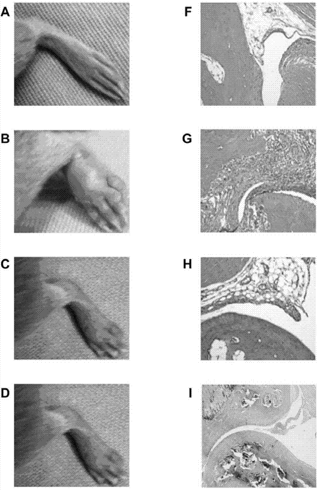 Application of polypeptide in preparation of drugs for treatment and/or prevention of rheumatoid arthritis