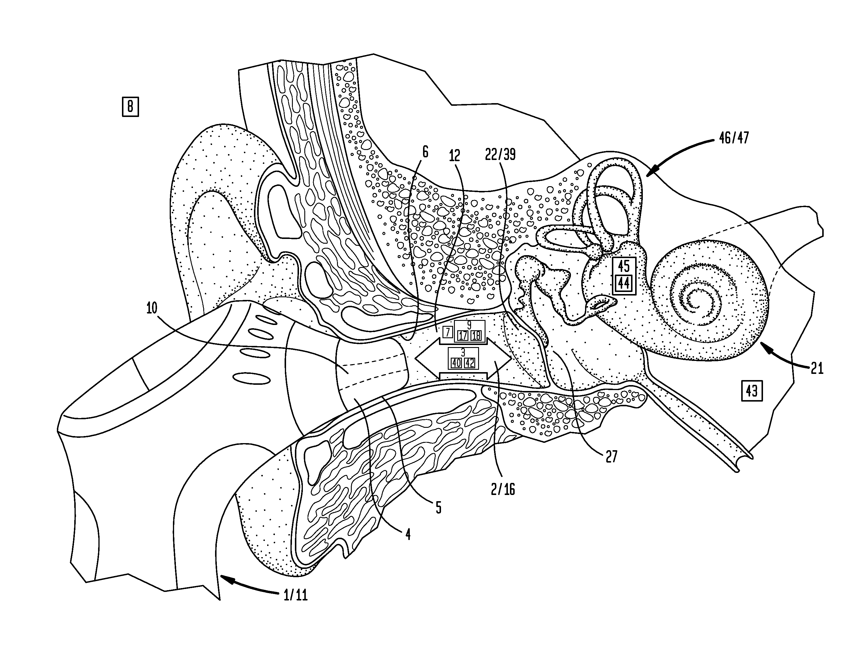 Method For External Ear Canal Pressure Regulation To Alleviate Disorder Symptoms