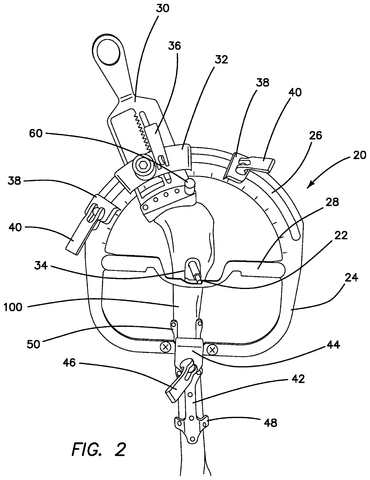 Method and Apparatus for Treating Cranial Cruciate Ligament Disease in Canines