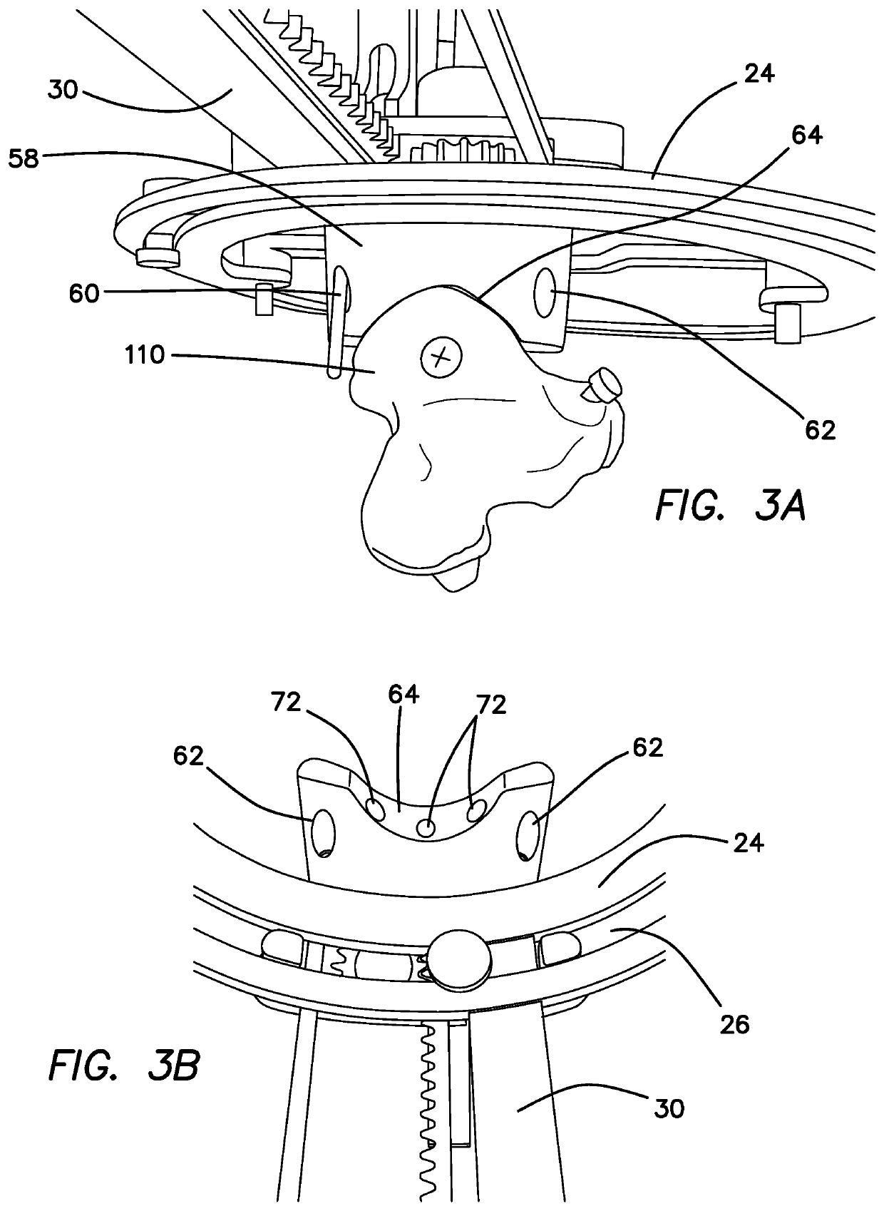 Method and Apparatus for Treating Cranial Cruciate Ligament Disease in Canines