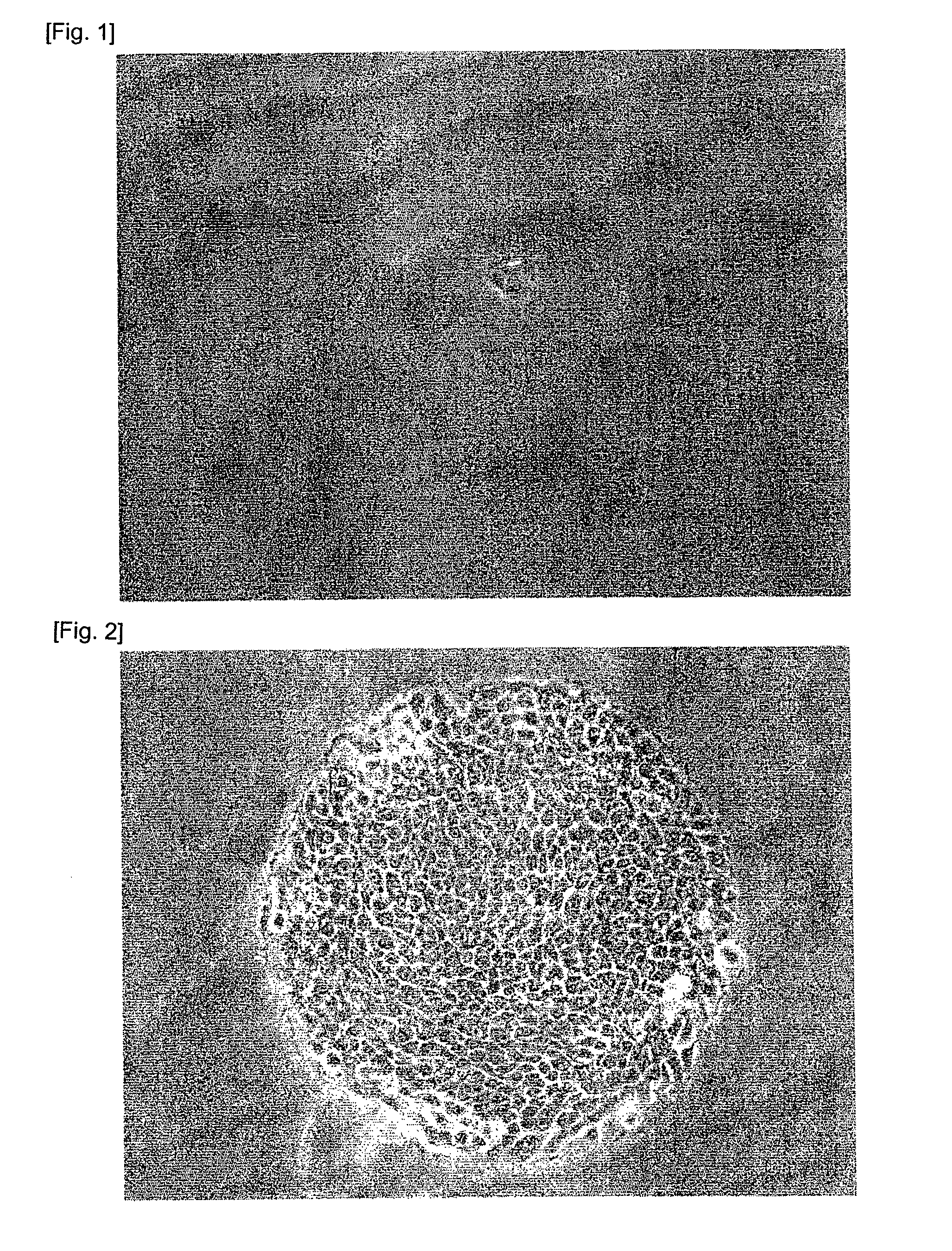 Method for isolation of cell, serum-free culture medium for cell, and method for culture of cell