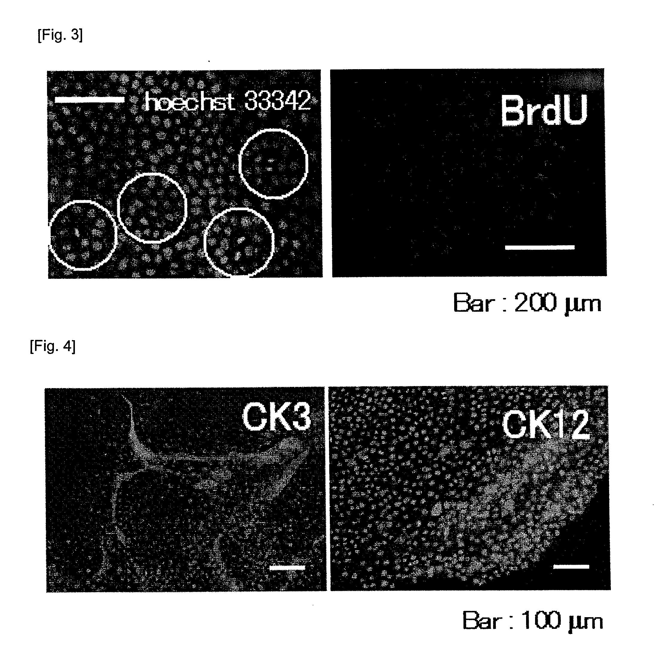 Method for isolation of cell, serum-free culture medium for cell, and method for culture of cell