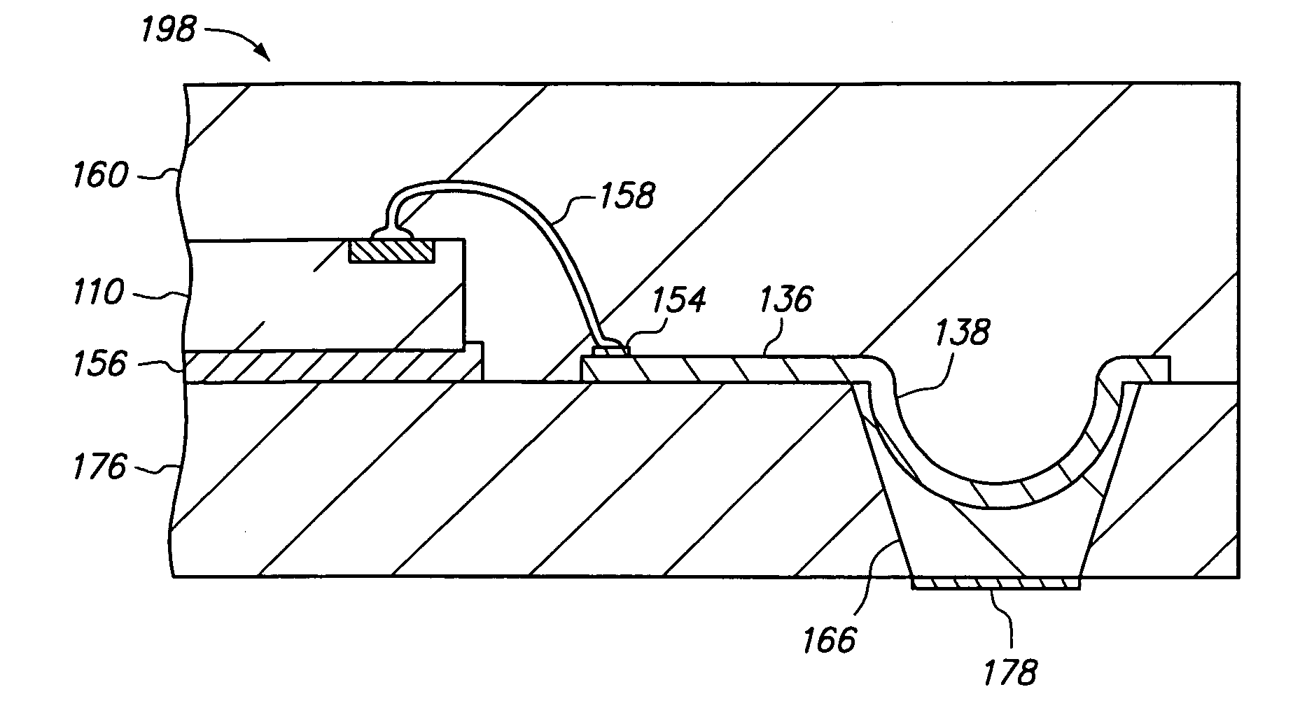 Semiconductor chip assembly with bumped metal pillar