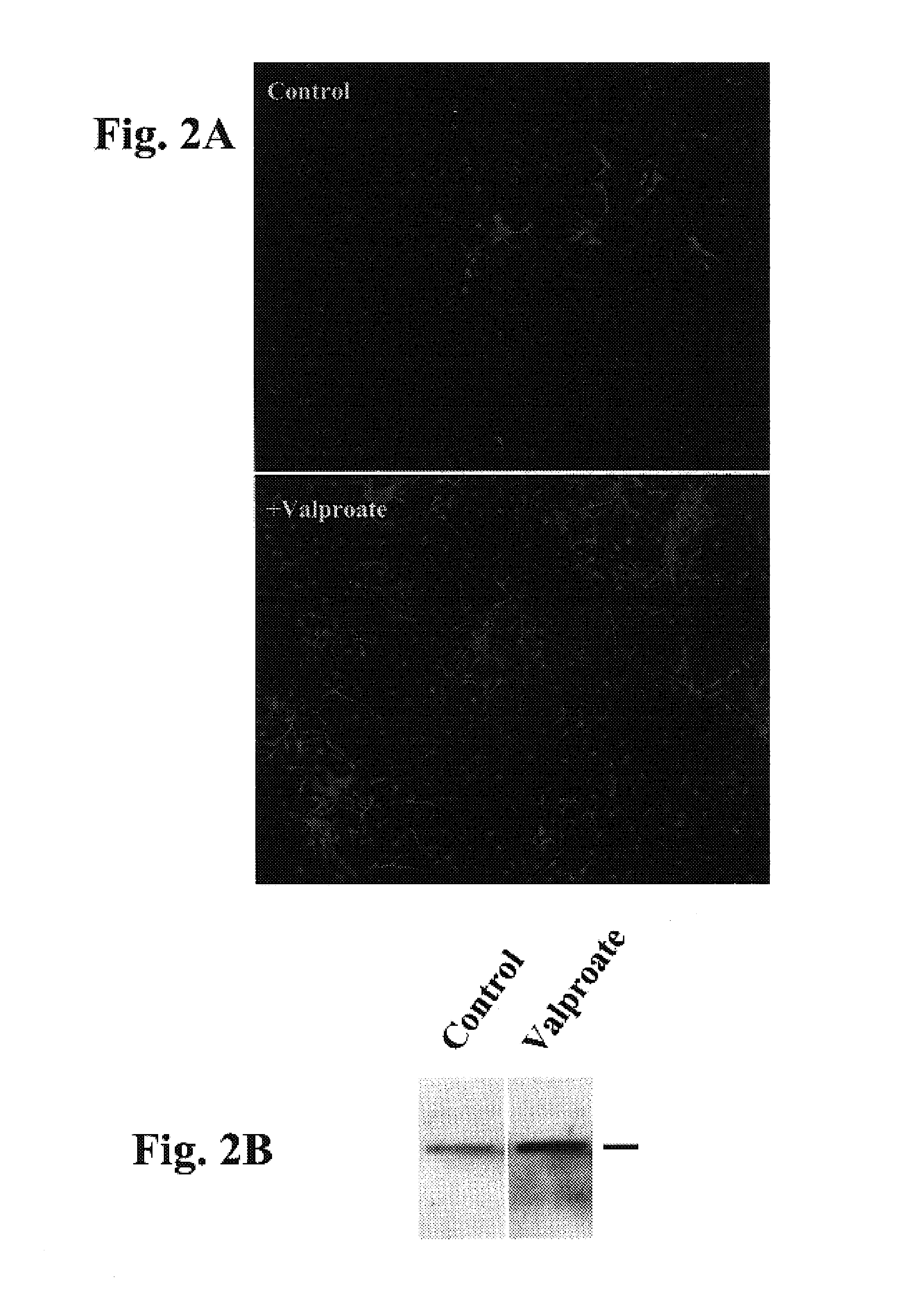 Method for neural stem cell differentiation using valproate