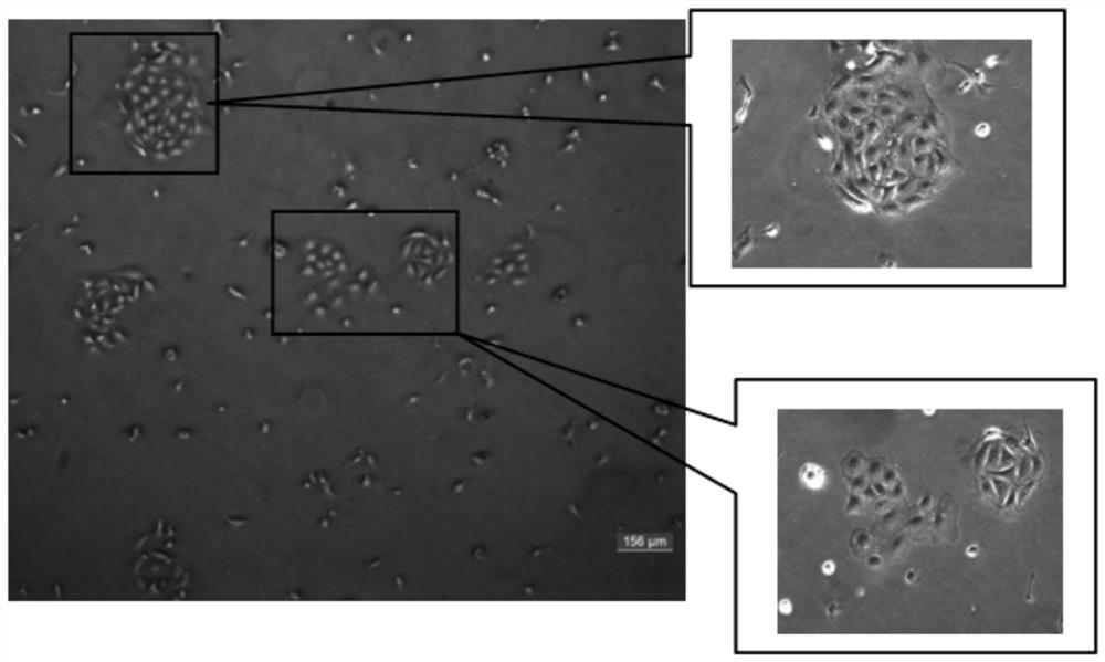 A method for isolating and culturing alveolar type II epithelial cells of naked mole rats