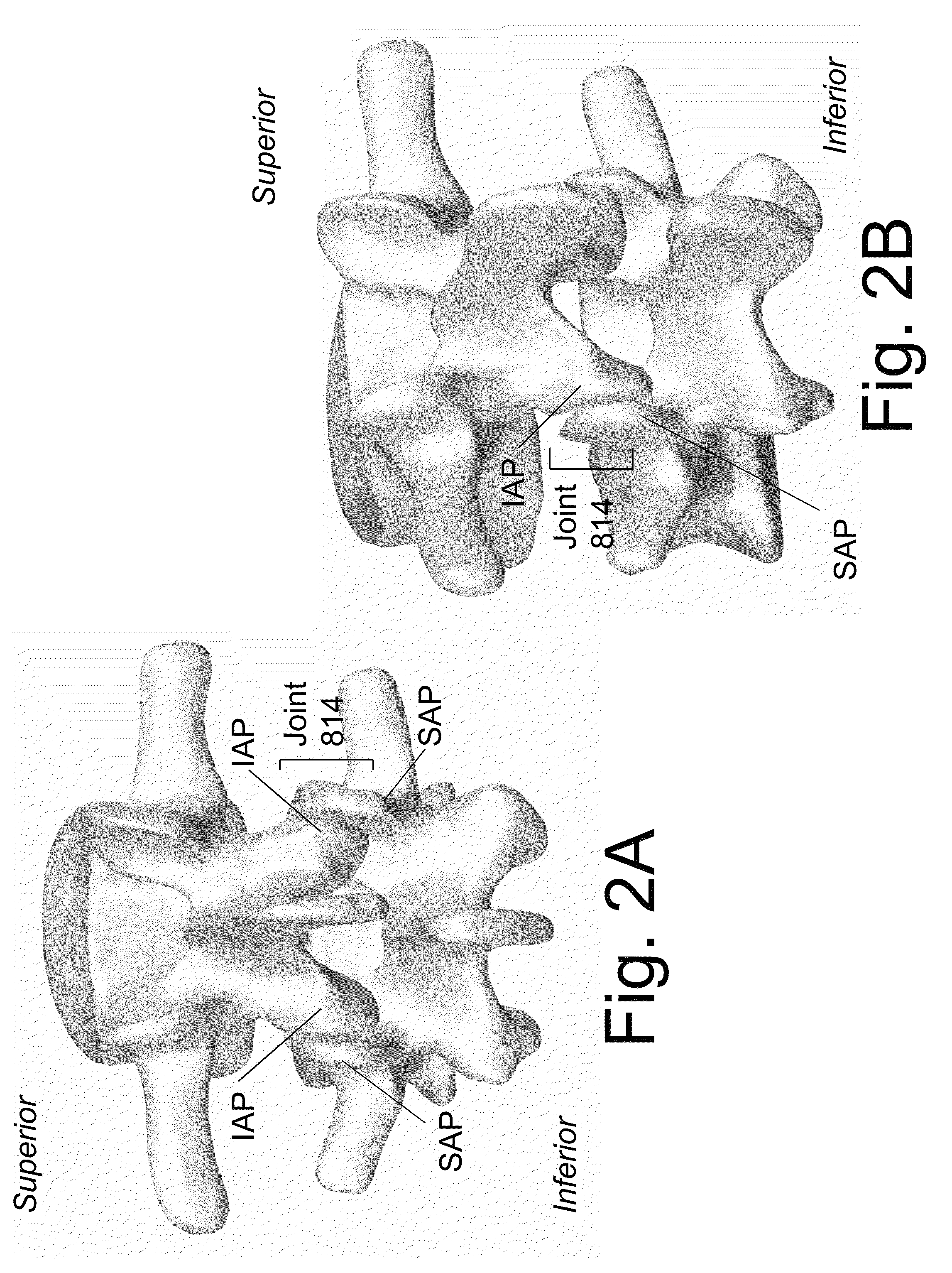 Devices and methods for minimally invasive spinal stablization and instrumentation