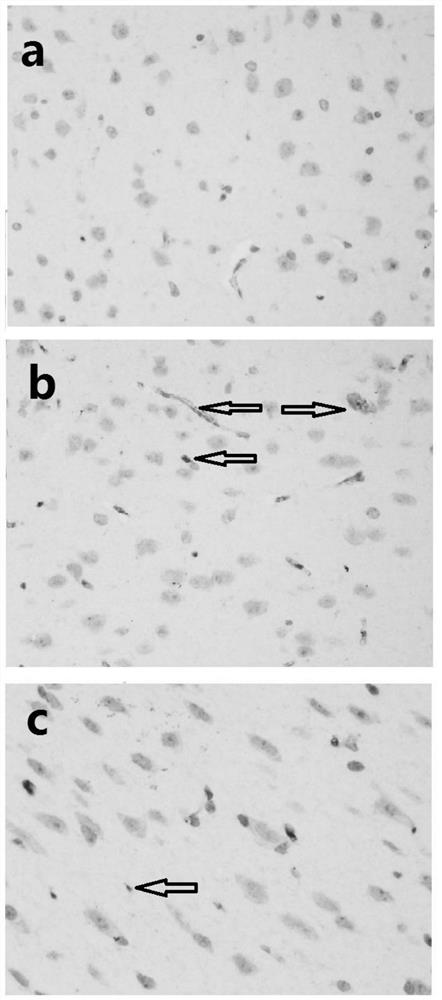 Application of Bacillus coagulans ja845 in the preparation of drugs for preventing and/or treating Alzheimer's disease