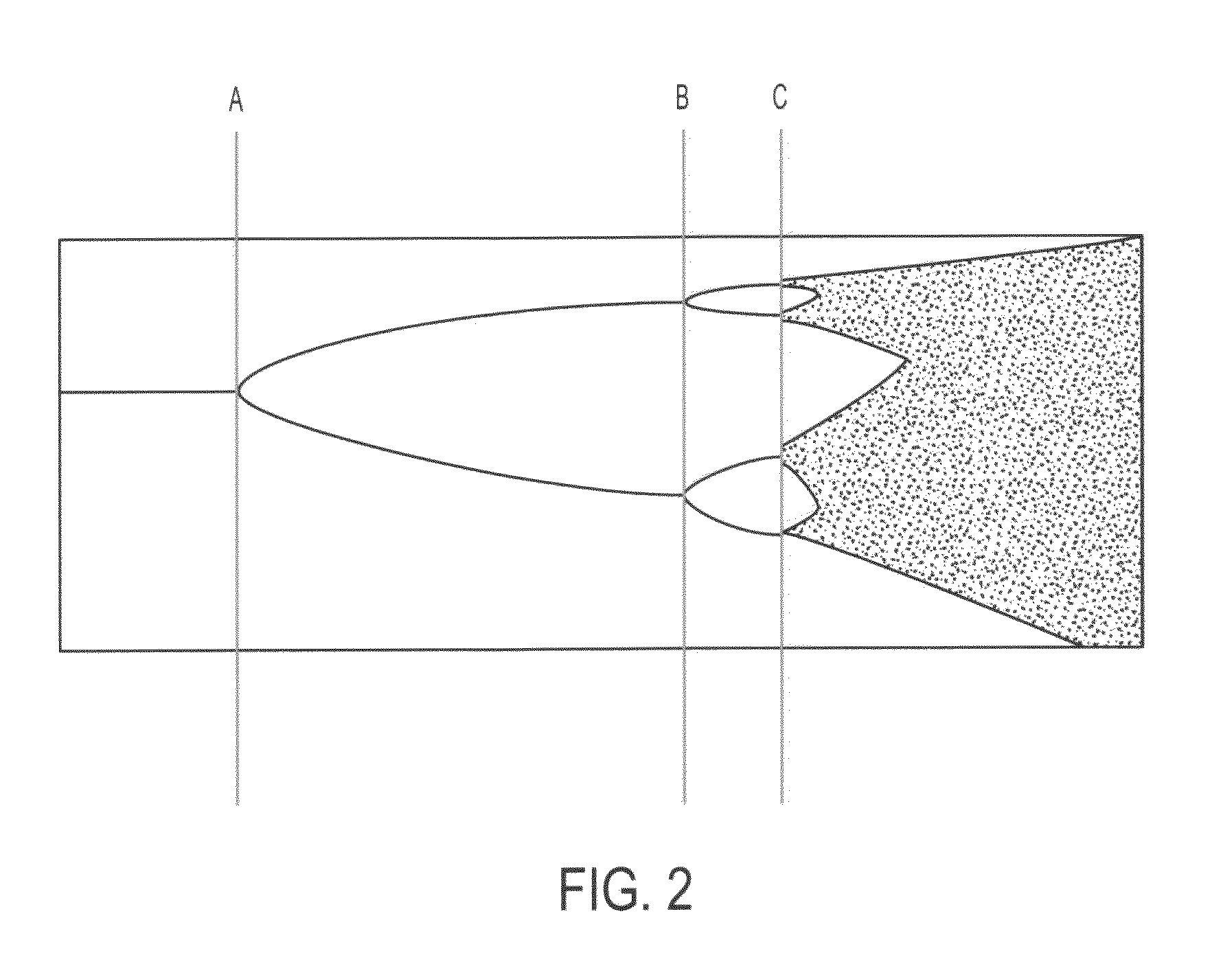 System and method for texture visualization and image analysis to differentiate between malignant and benign lesions