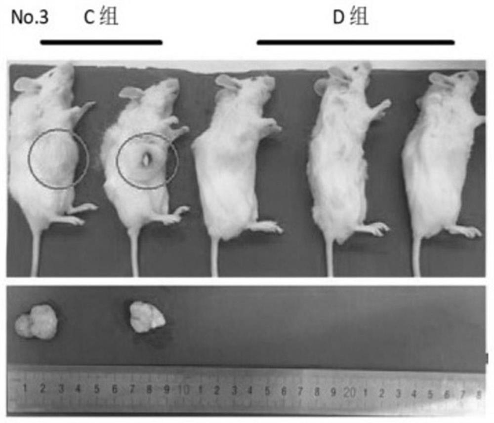 A method for establishing a xenograft tumor model derived from colorectal cancer patients based on a temperature-sensitive biogel three-dimensional culture system